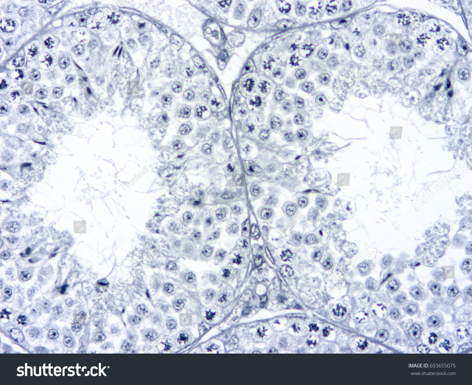 Histology Human Testis Tissue Show Spermatogenesis Foto Stok 693655075