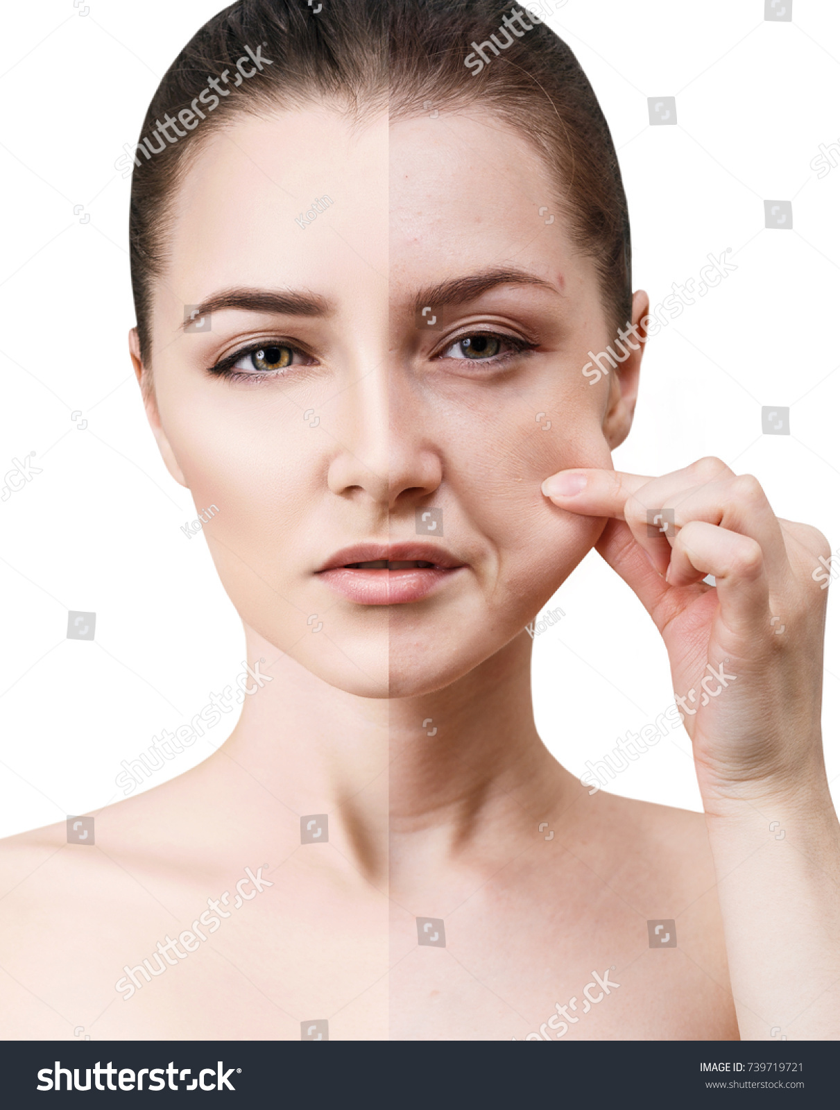 Womans Face Before After Rejuvenation Stock Photo Shutterstock