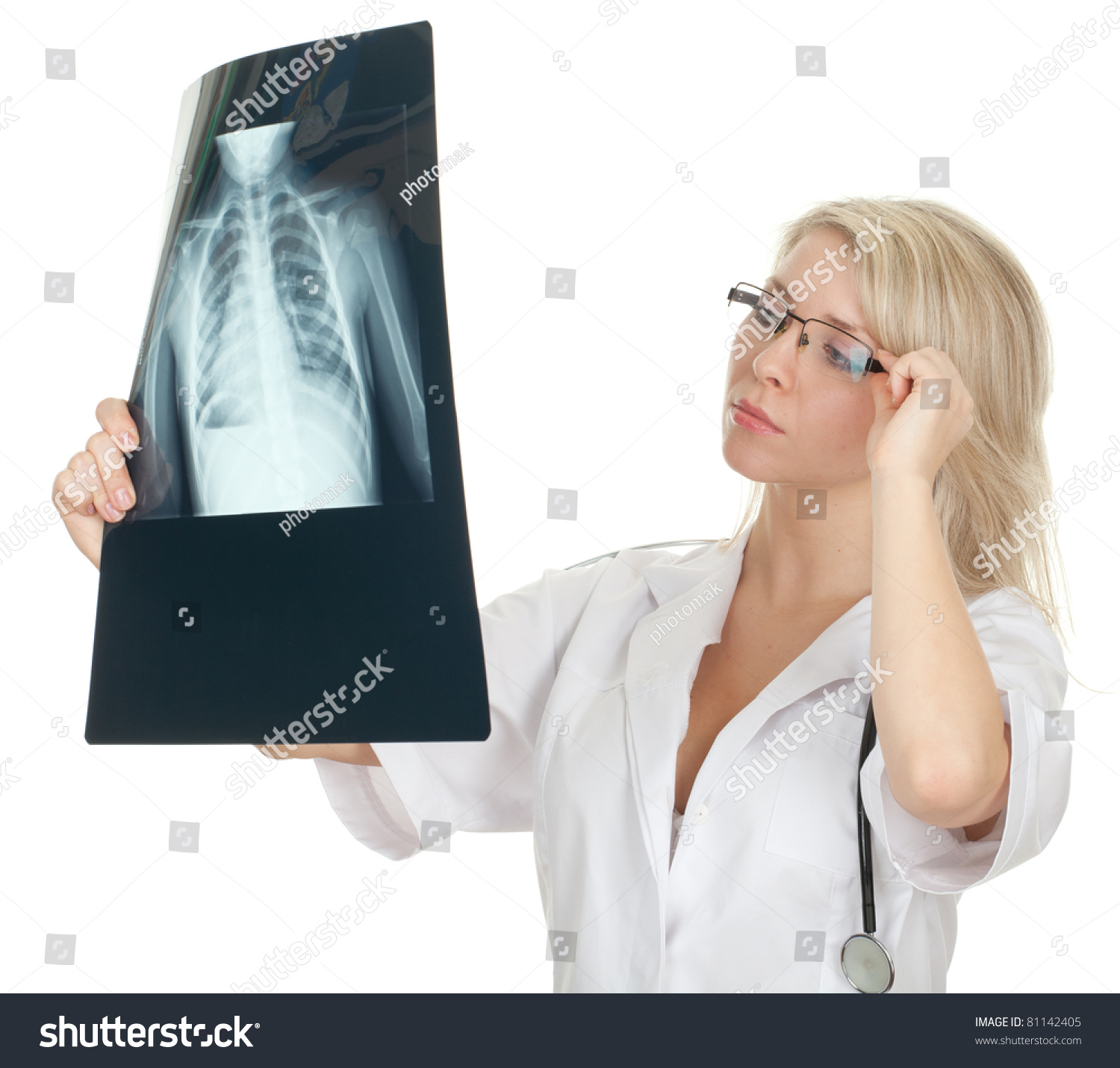 Female Doctor White Uniform Reading Xray Stock Photo