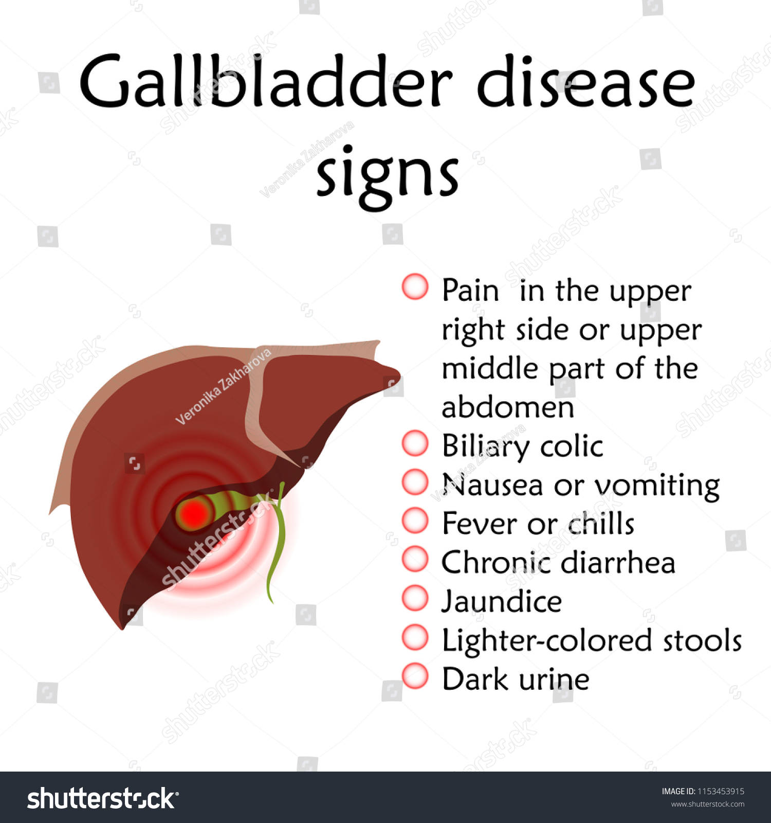 Gallbladder Disease Signs Inflammation Royalty Free Stock Vector