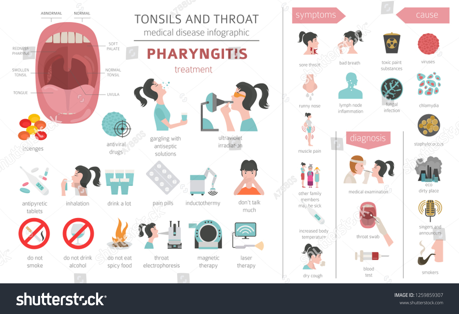 Tonsils And Throat Diseases Pharyngitis Royalty Free Stock Vector