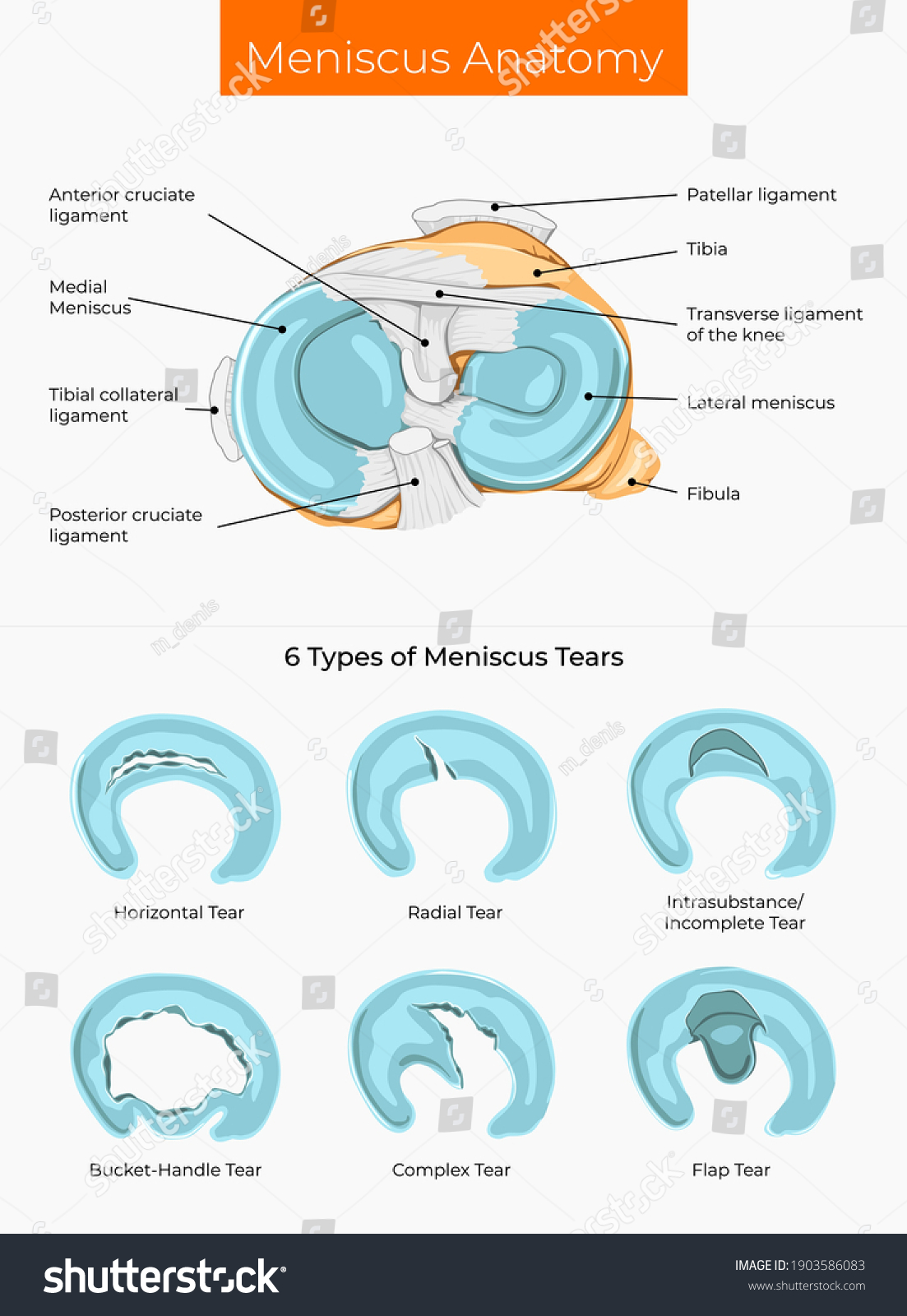 Vector Illustration Meniscus Anatomy And Royalty Free Stock Vector