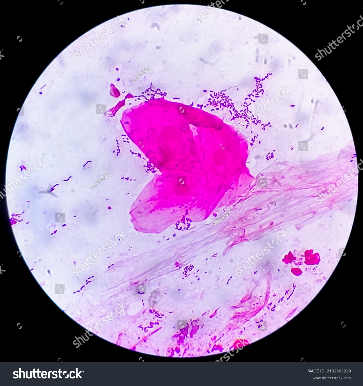 Gram Stain Gram Positive Cocci Gram Positive Royalty Free Stock