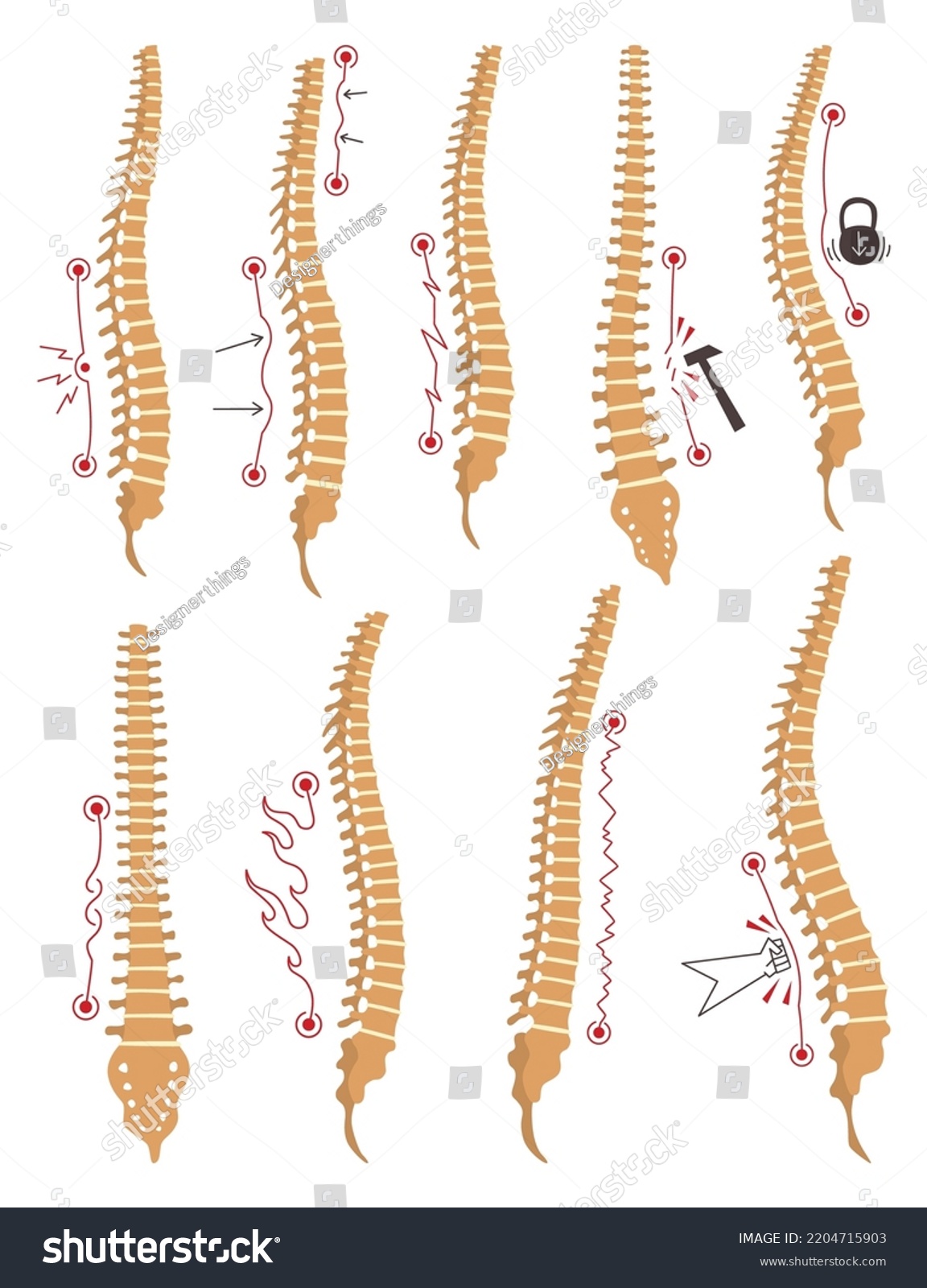 Spinal Deformity Types Symbols Of Spine Royalty Free Stock Vector