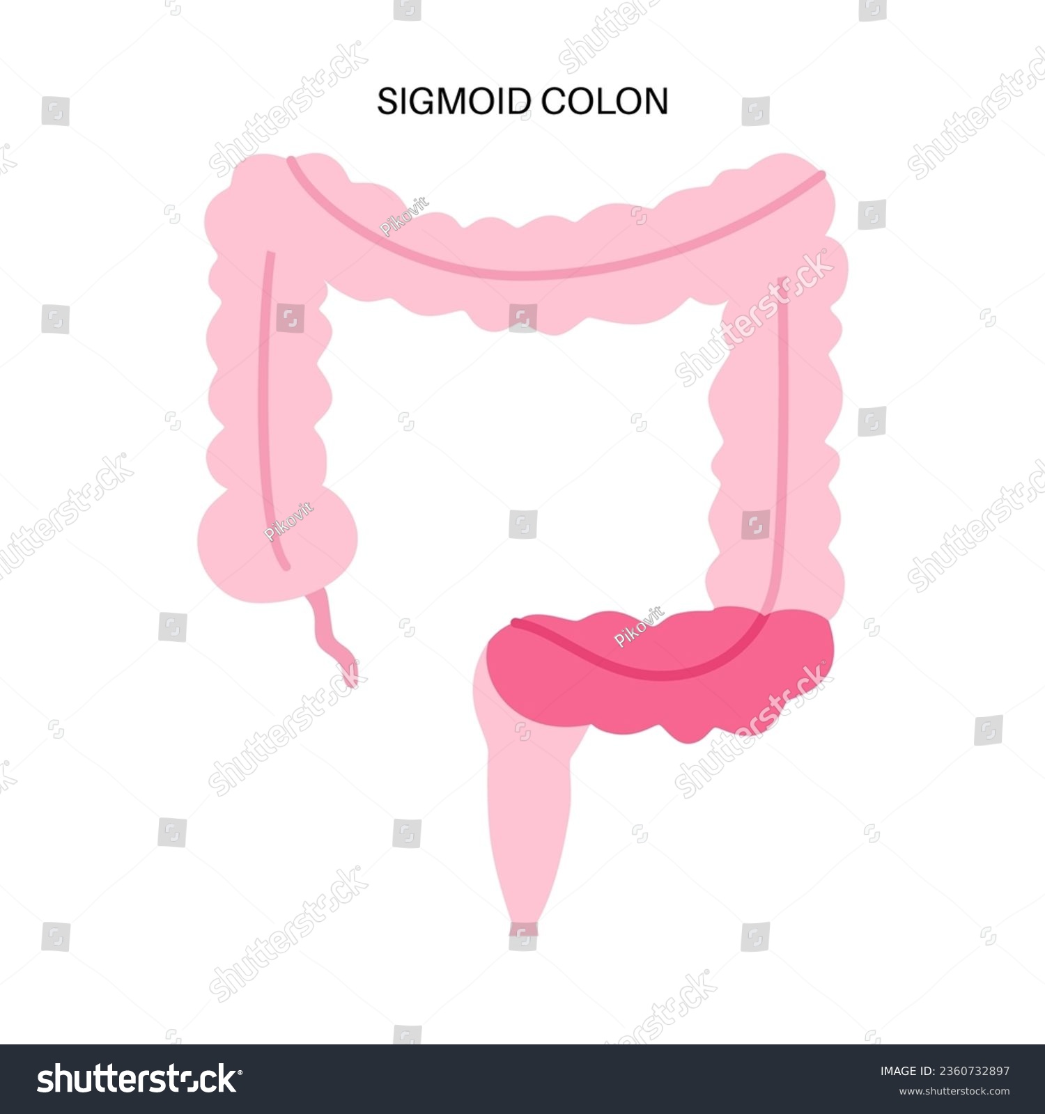 Sigmoid Colon Poster Large Intestine In The Royalty Free Stock