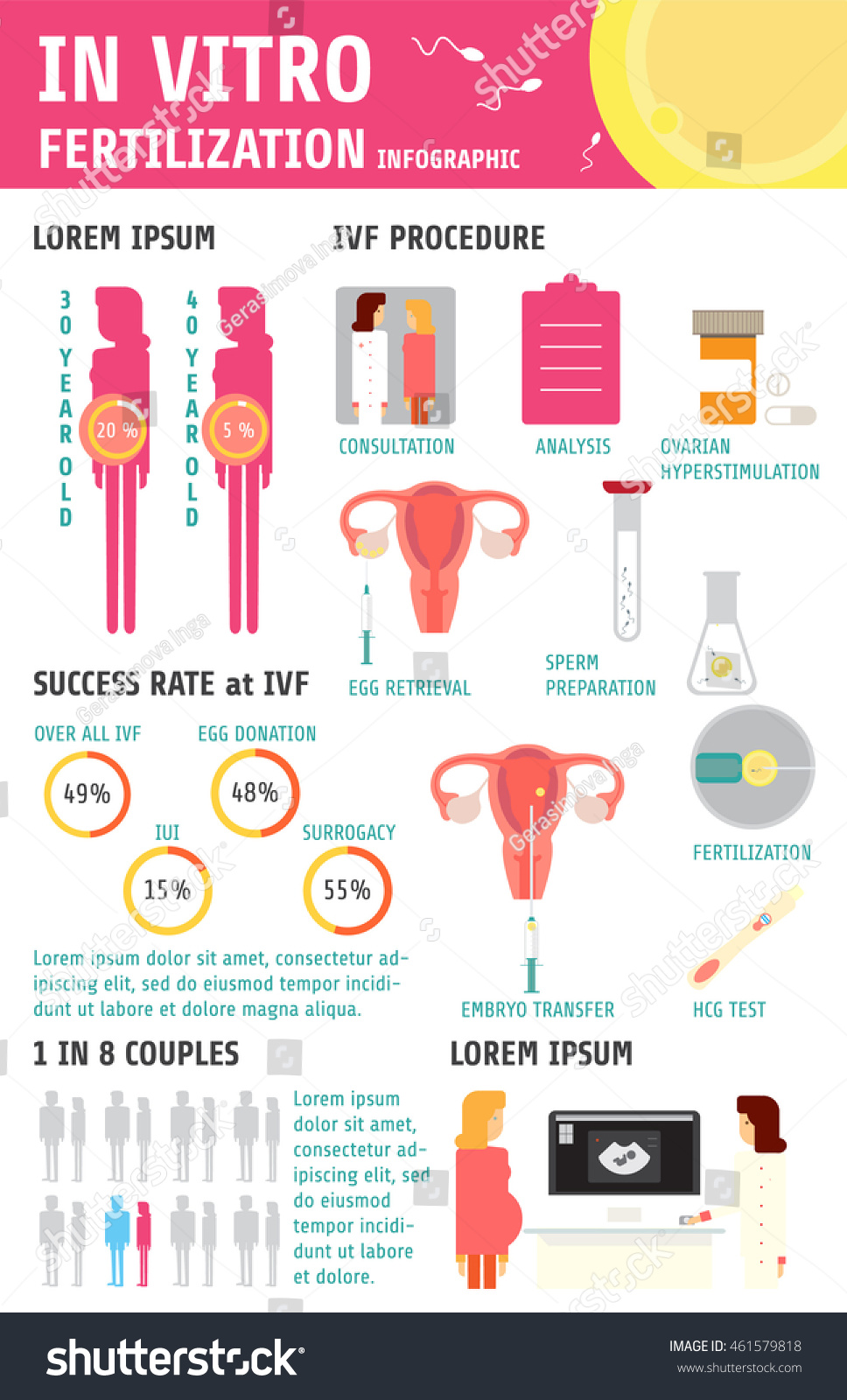 In Vitro Fertilization Infographic Charts And Royalty Free Stock