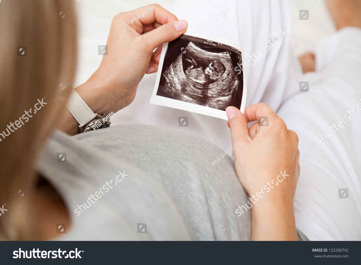 Baby scan deals manchester