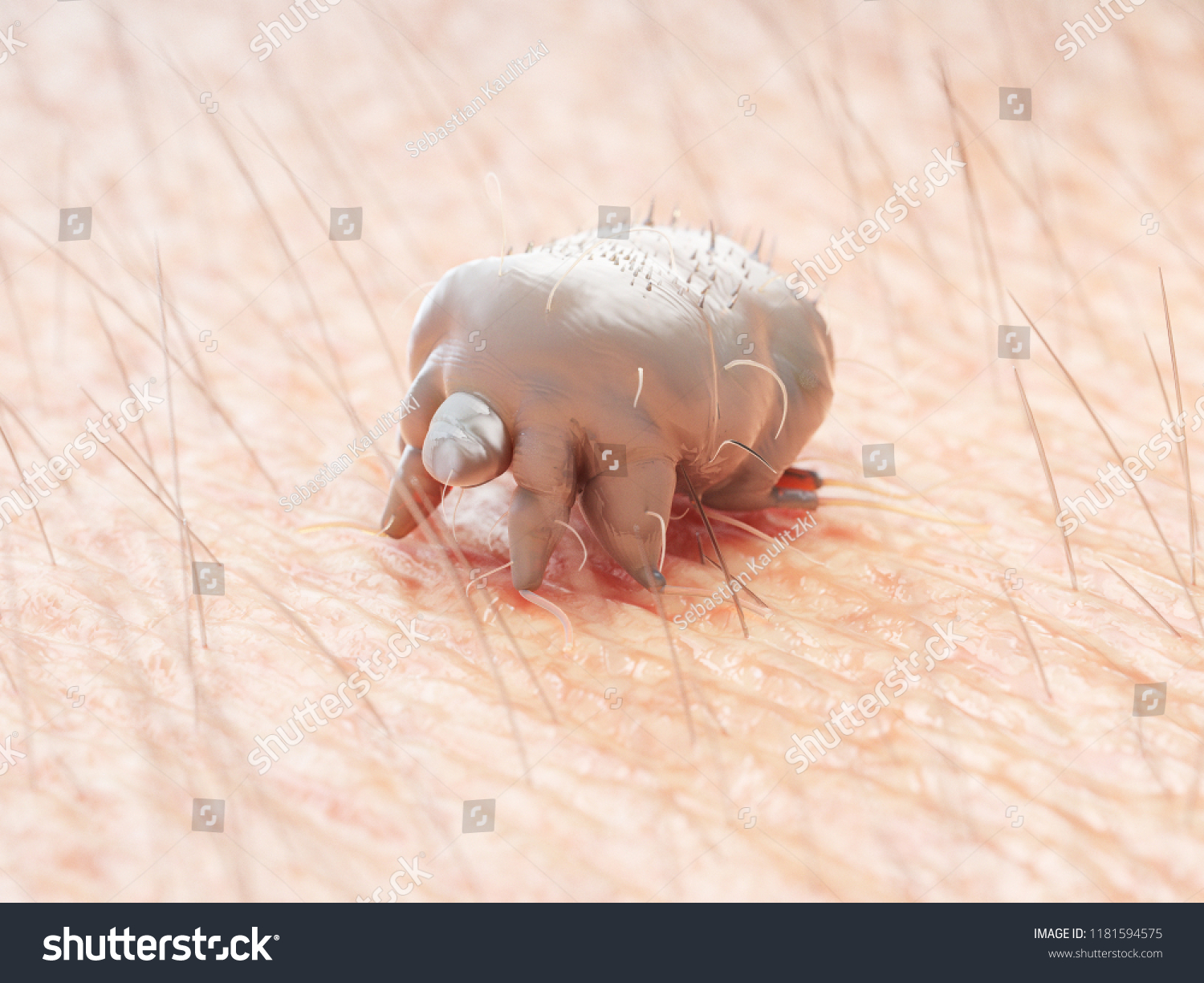 Sarcoptes Scabiei Afbeeldingen Stockfotos En Vectoren Shutterstock