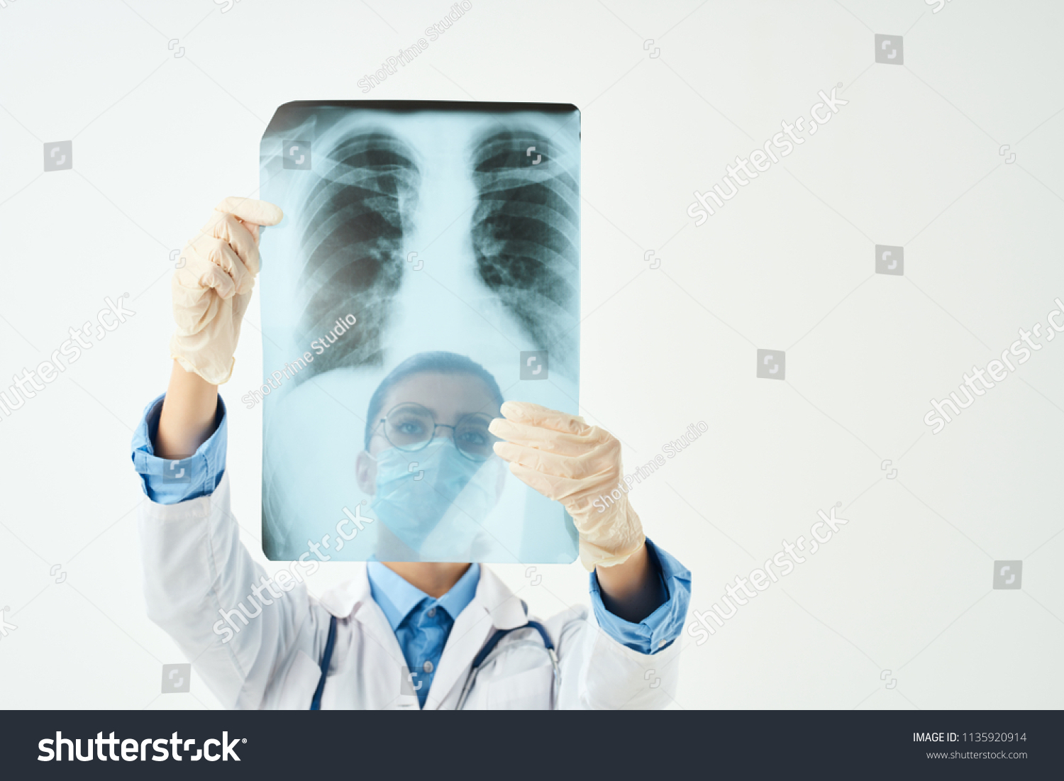 Surgeon Looks Xray Traumatology Hospital Fractures Stock Photo