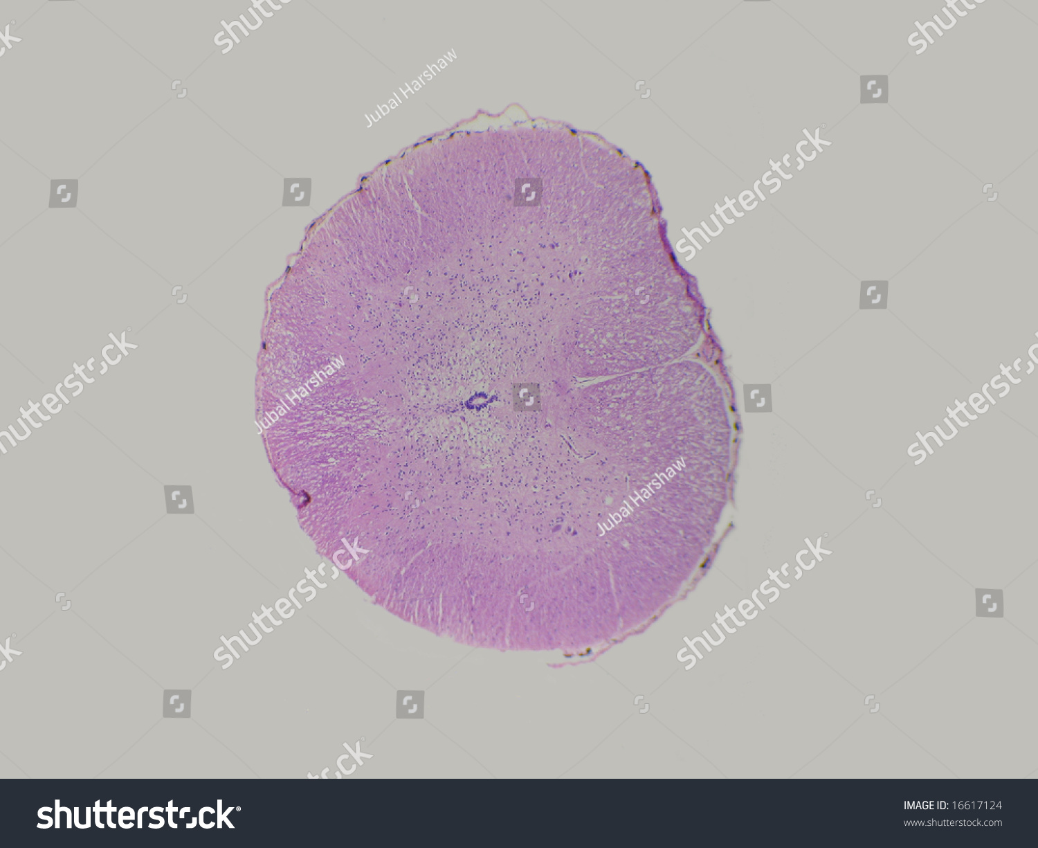 A Microscopic Cross Section View Of A Frog Spinal Cord Stock Photo