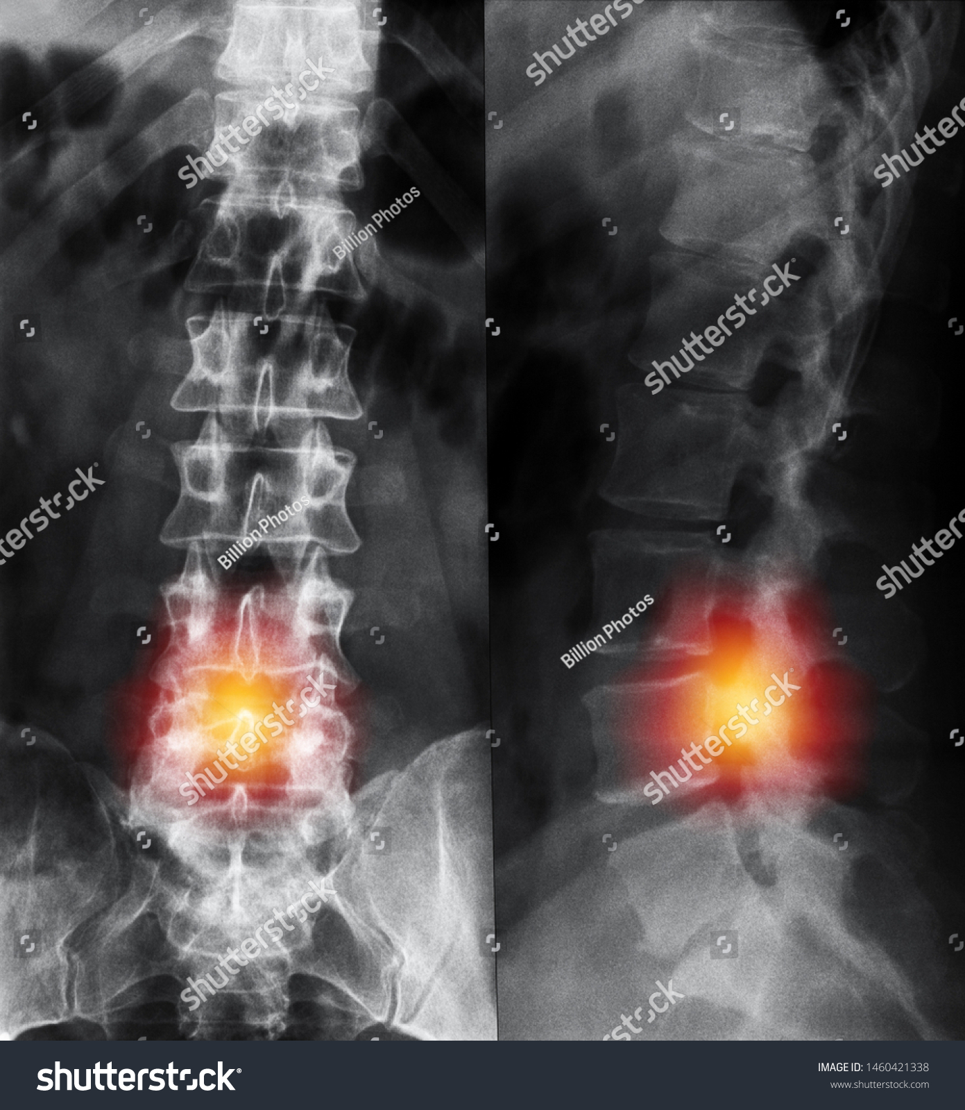 Sagittal View Magnetic Resonance Image Mri Stock Photo Edit Now