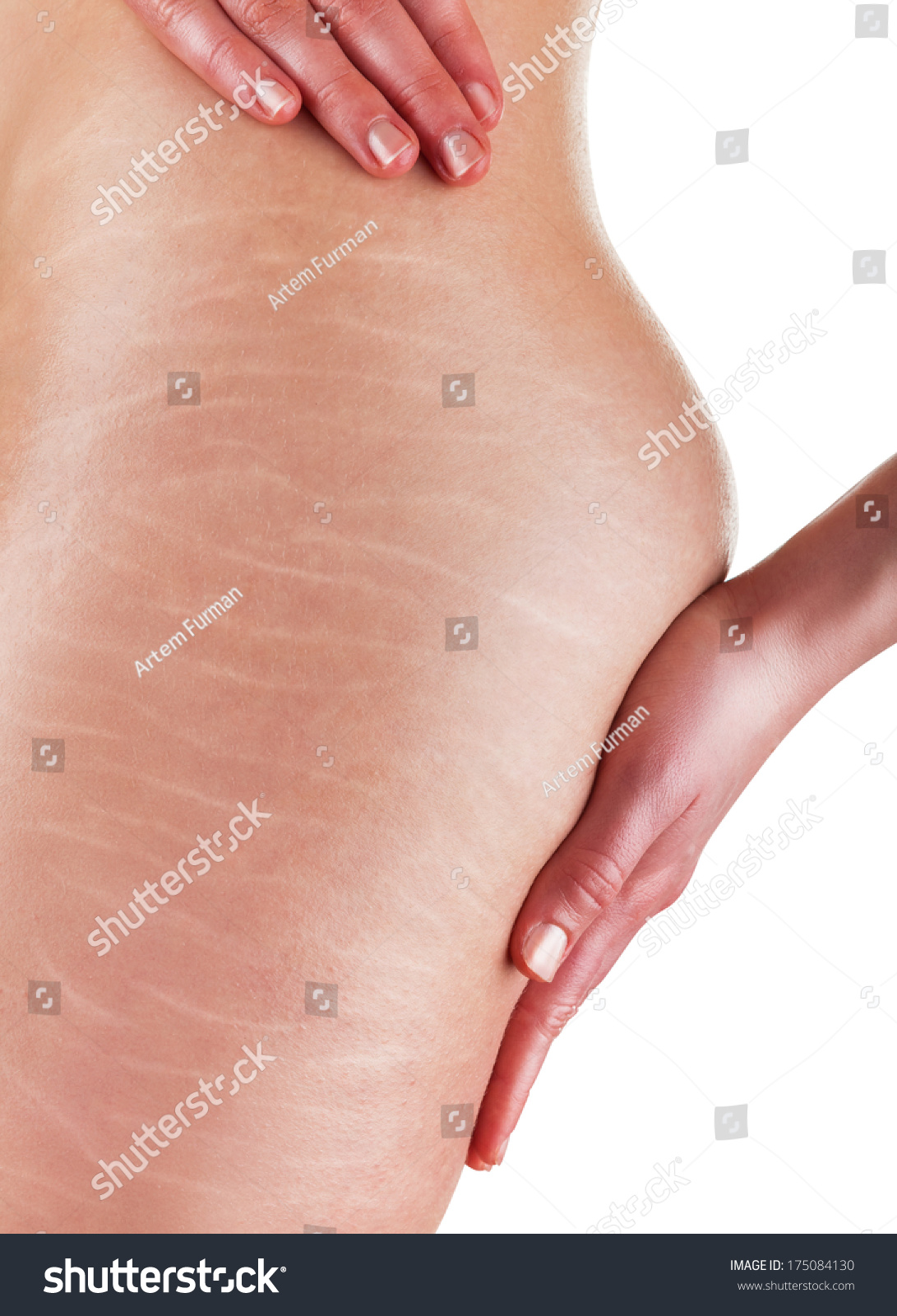 Hiring twink models stretch marks - Hot porno Free photos adult sex fetish