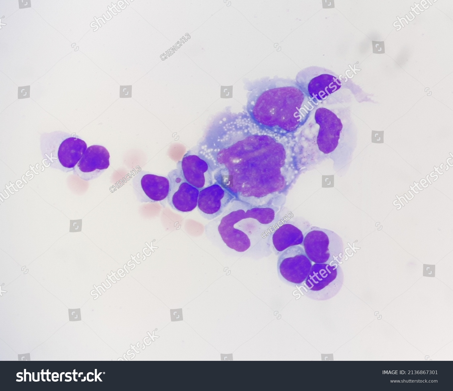 Abnormal Cells Body Fluid Stock Photo Edit Now 2136867301