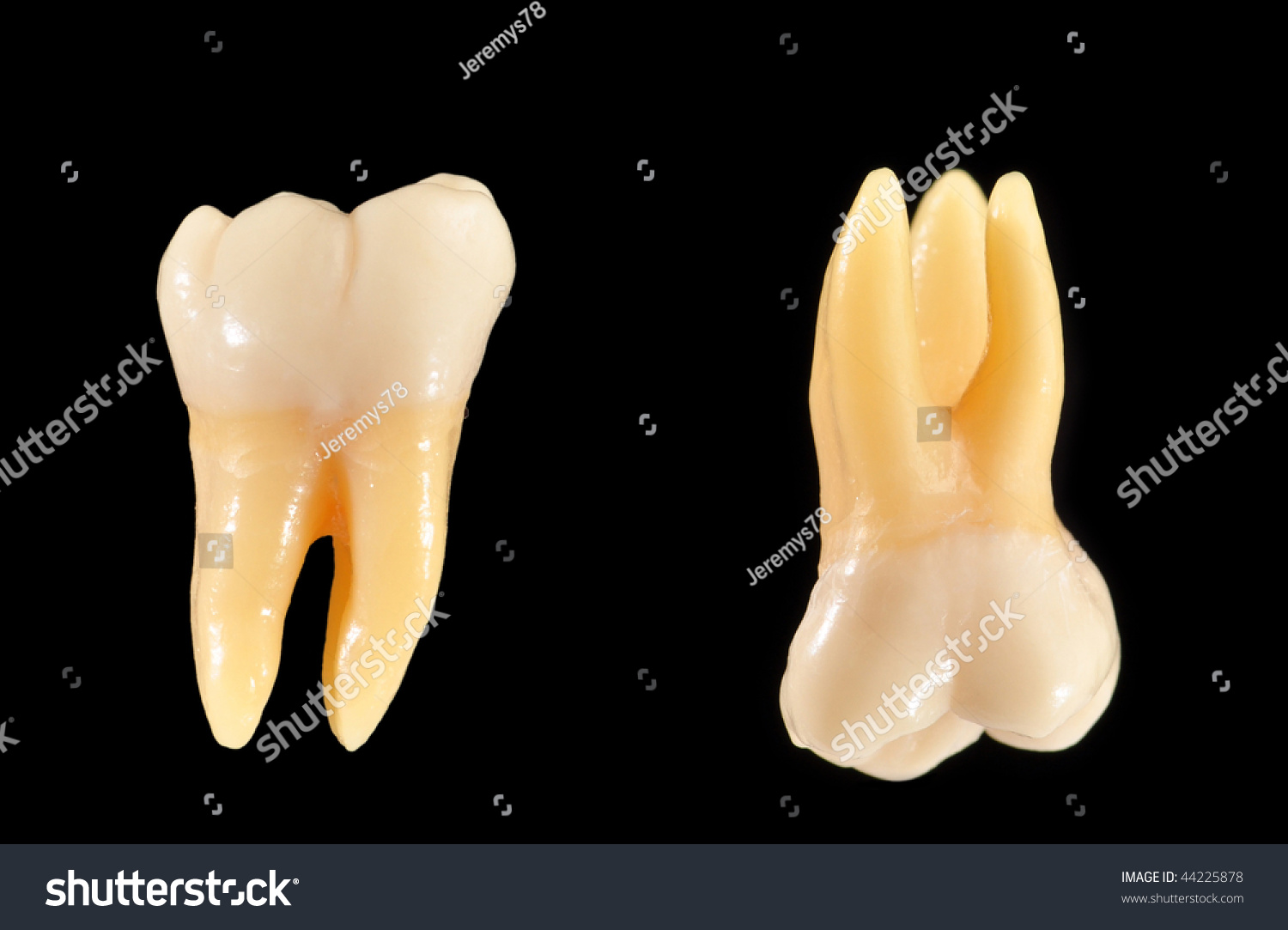 Accurate Typodont Teeth Are Shown Isolated On Black. These Teeth Are