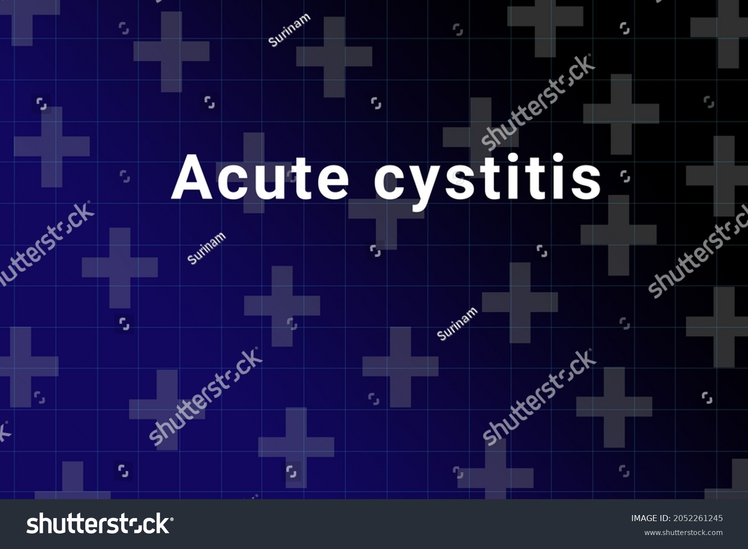 Acute Cystitis Disease Illustration Acute Cystitis Stock Illustration