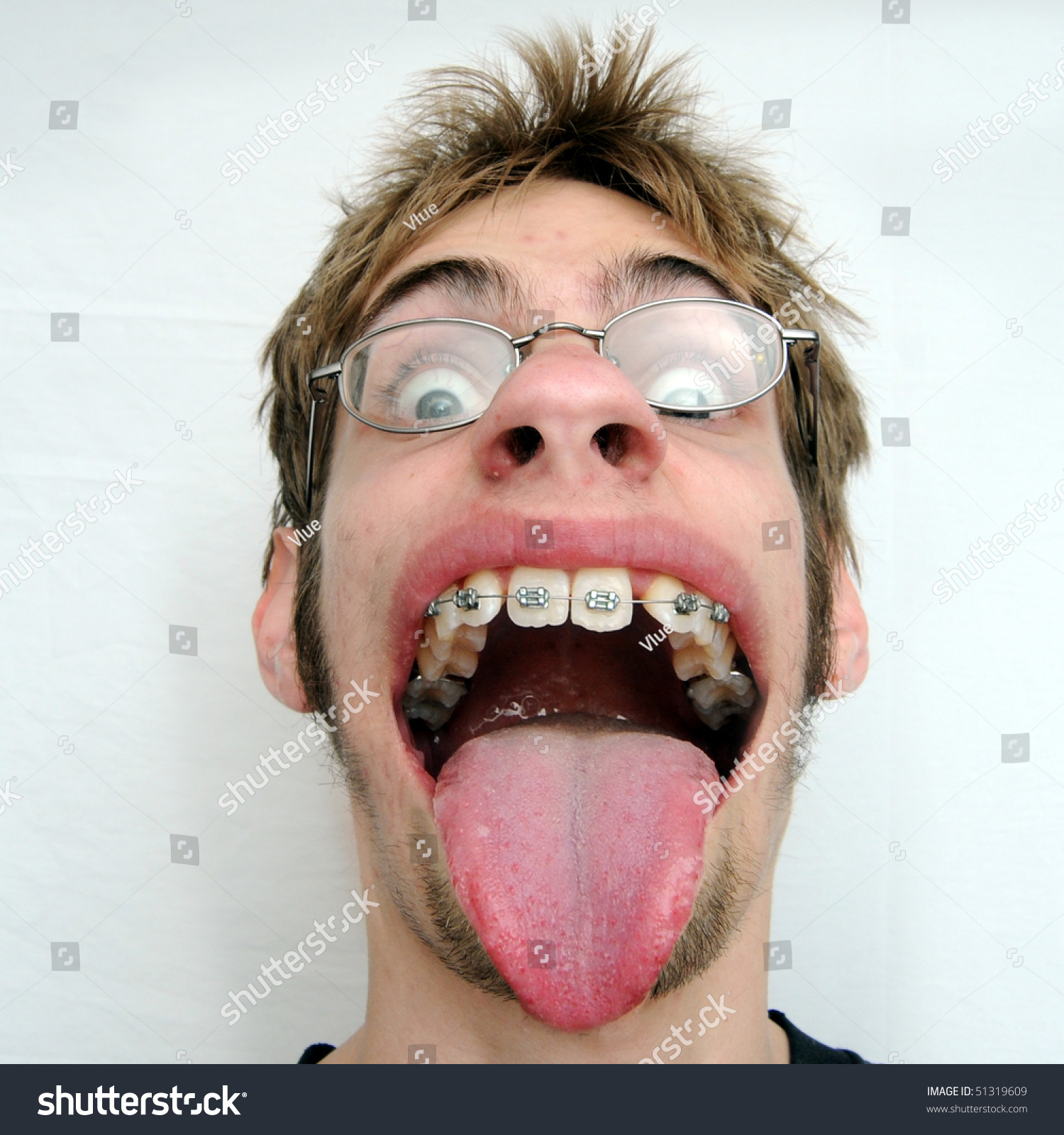 Guy With Huge Mouth 43