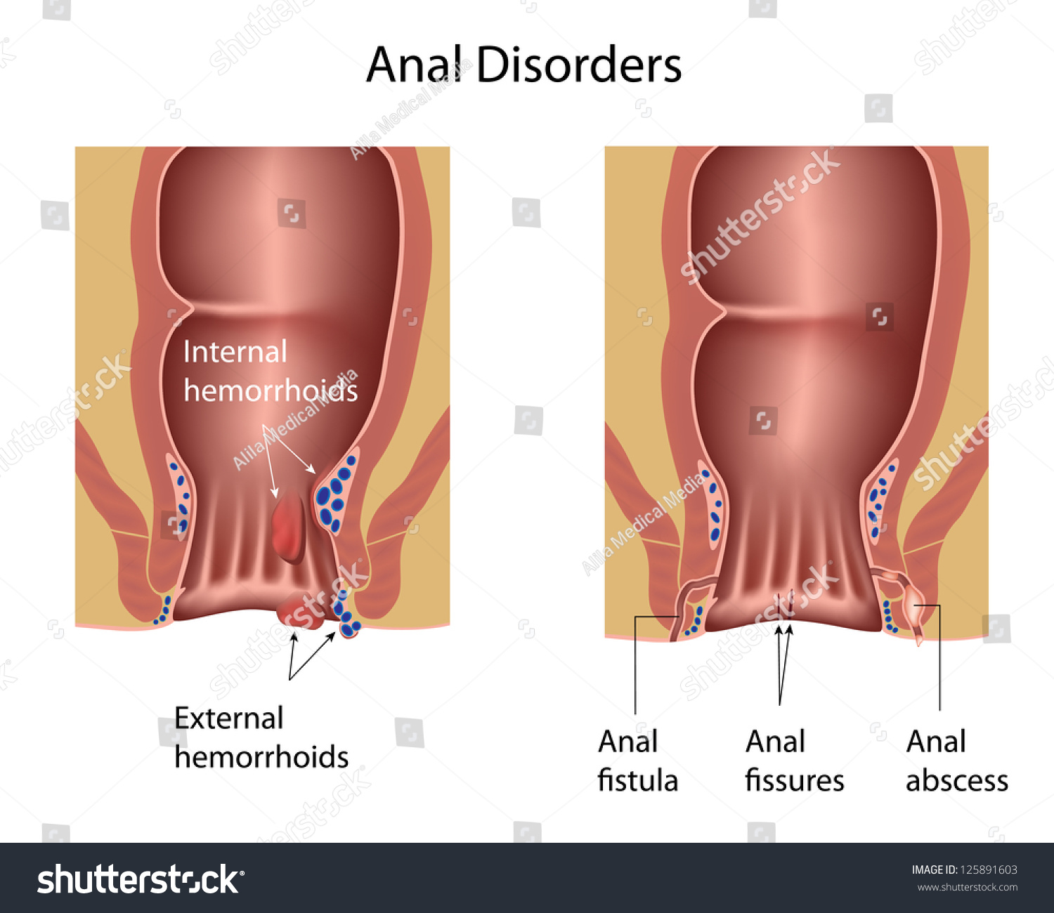 Pics Of Anal 65