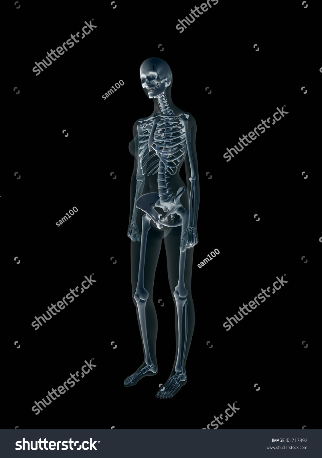 Anatomically Correct Xray Xray Human Female Stockillustration 717892