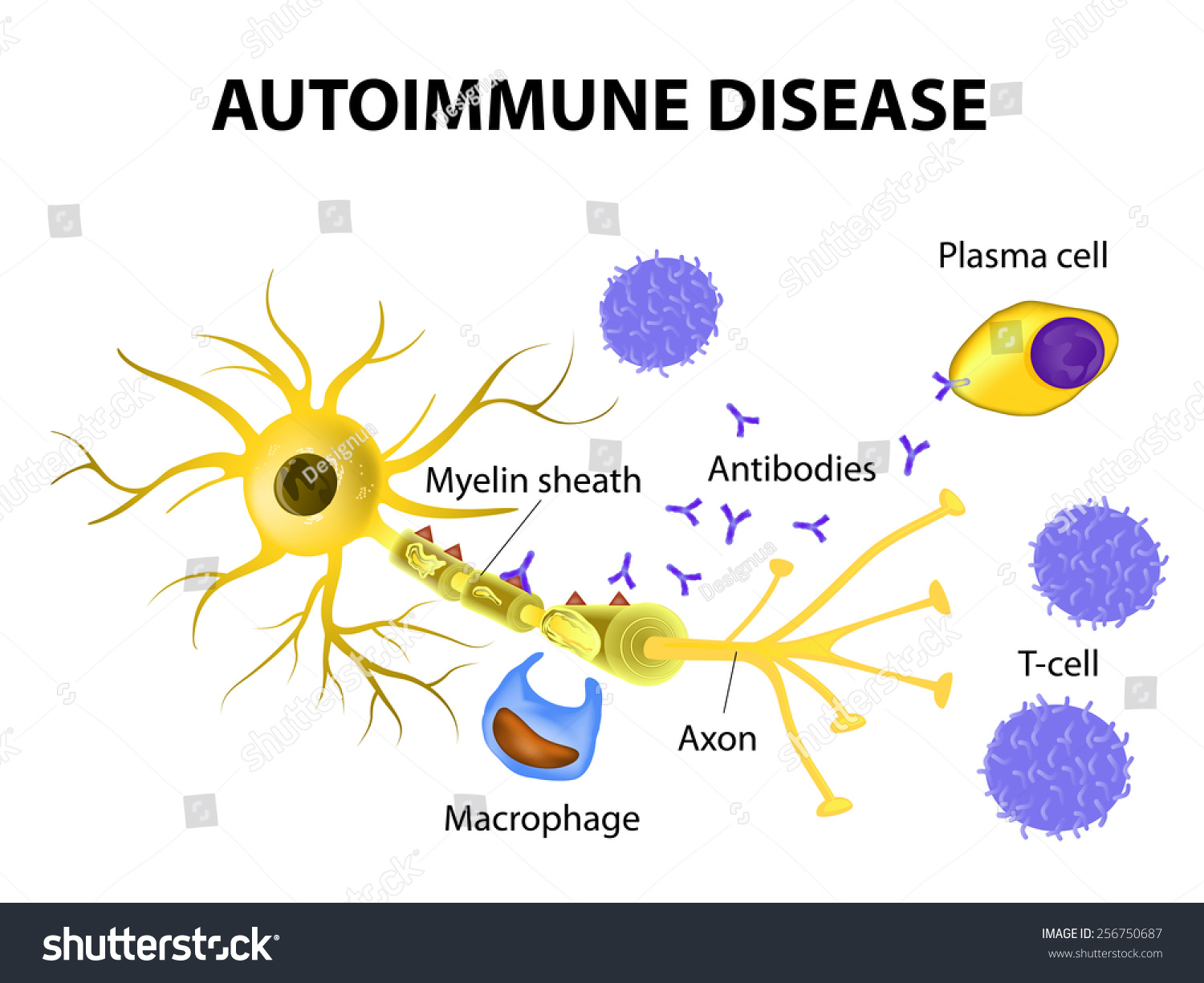 Autoimmune Disease Multiple Sclerosis Immune Cells Attack The Myelin 