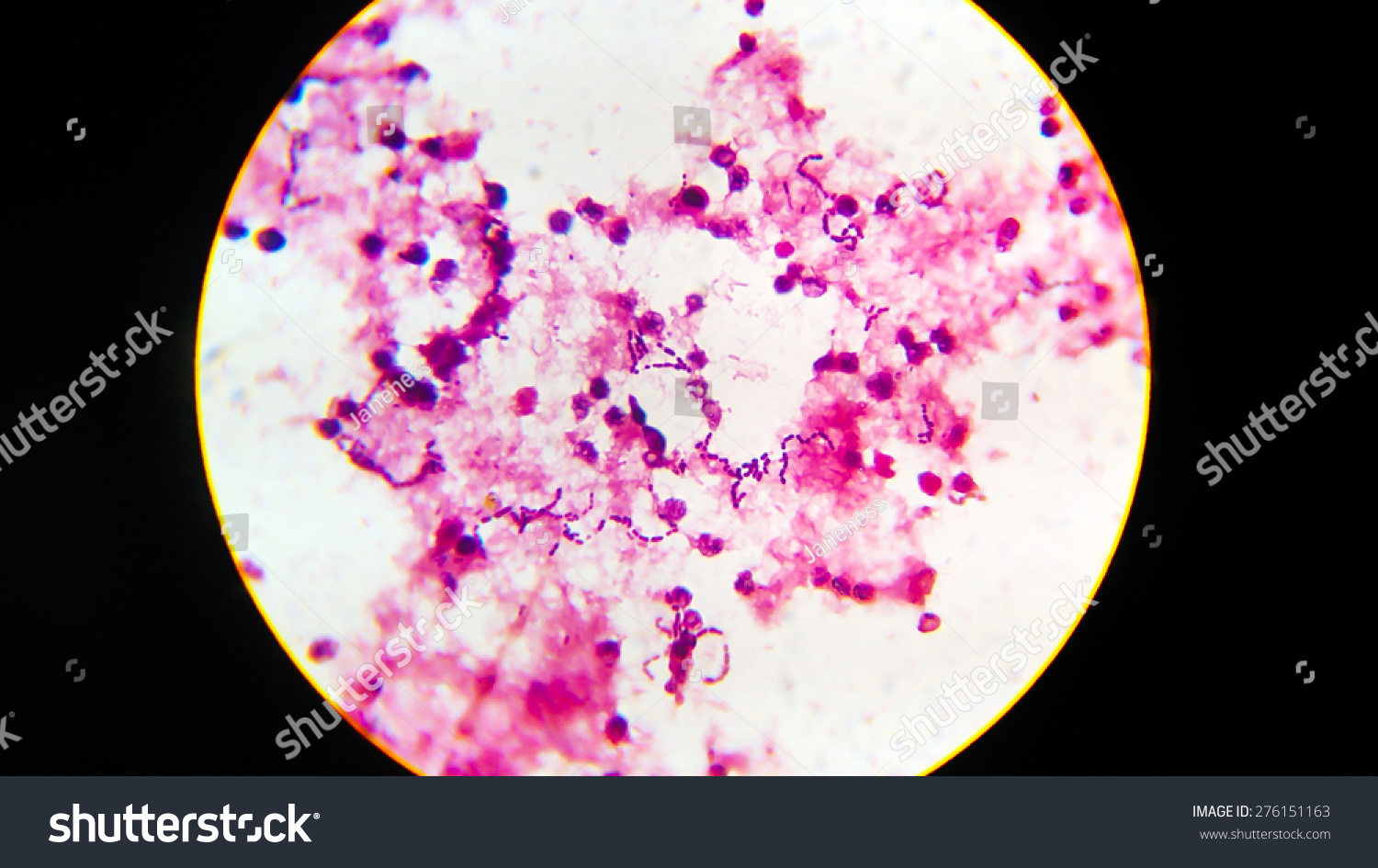 Bacteria Gram Staining Under Microscope Shutterstock