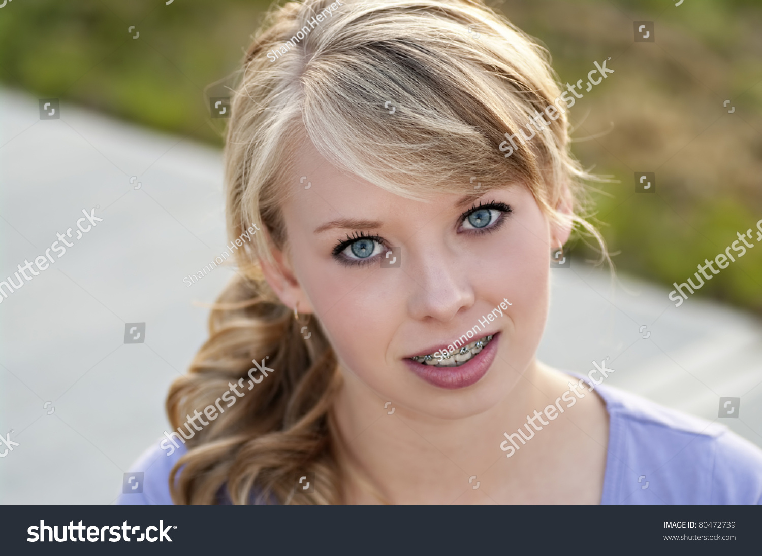 Beautiful Teen Girl With Braces Stock Photo 80472