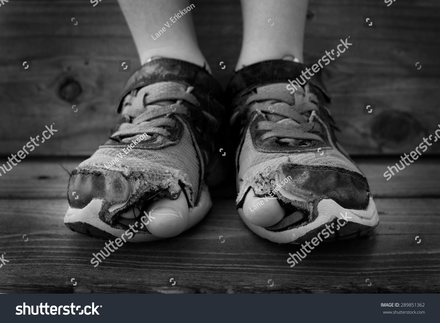 toe poking through shoe
