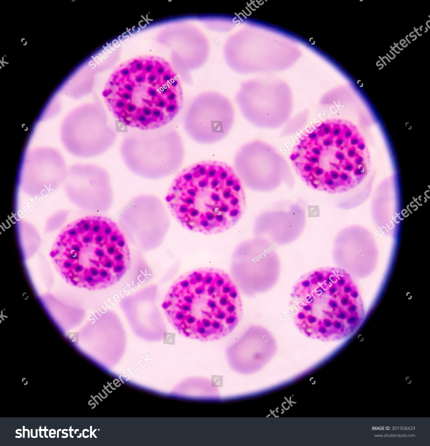 blood films for Malaria parasite.show malaria pigment blood films for Malaria parasite.show malaria pigment