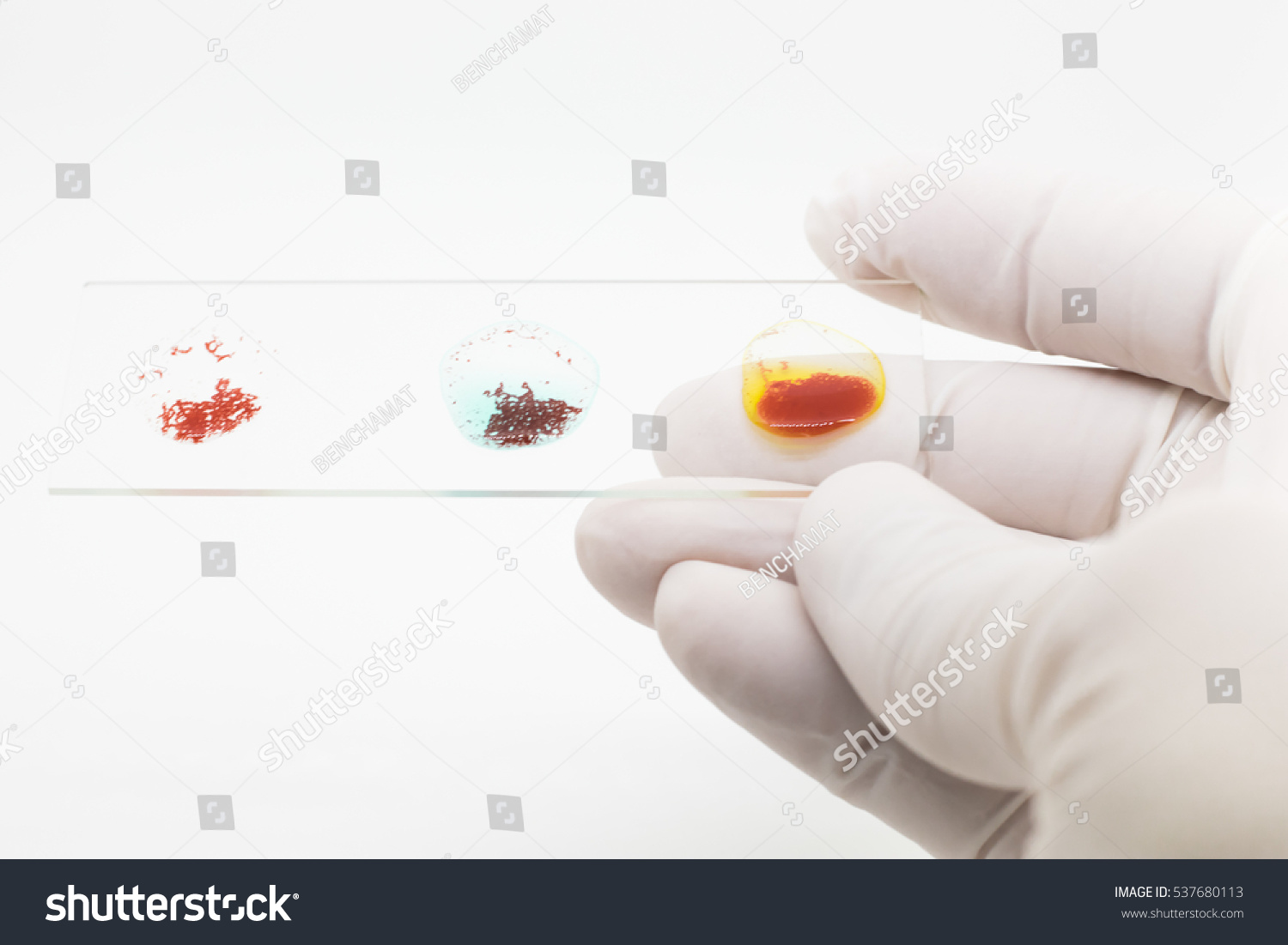 Blood Group Testing By Slide Agglutination Stock Photo Edit Now 537680113