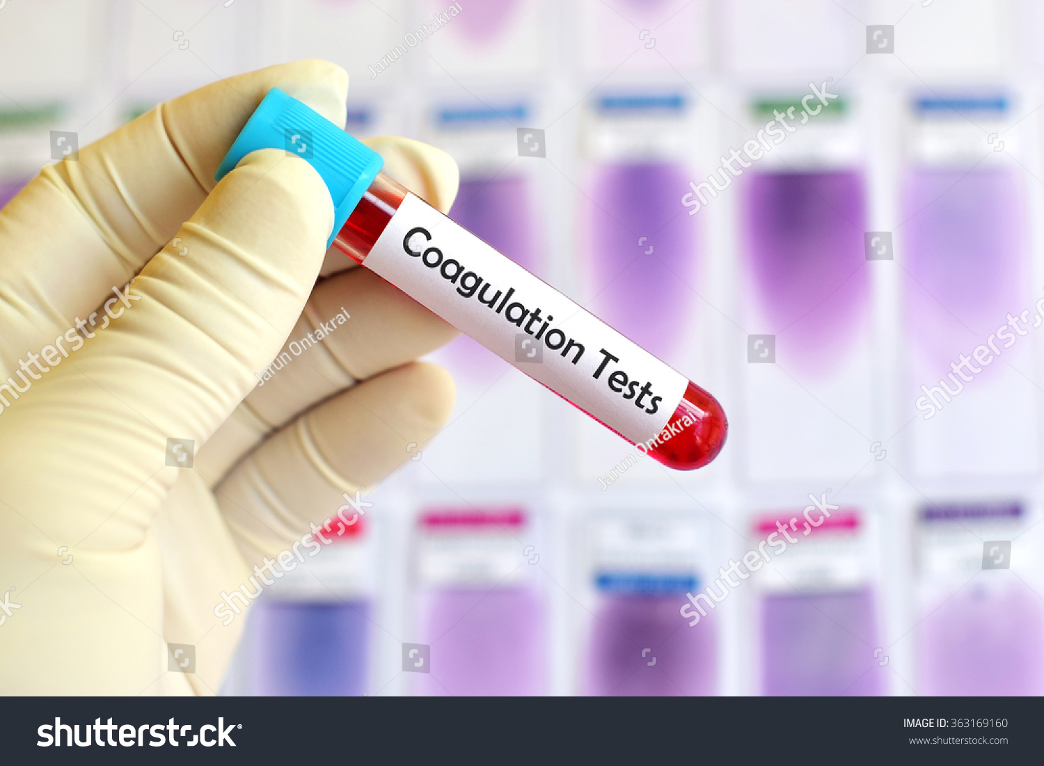 Blood Sample Coagulation Testing Stock Photo 363169160 - Shutterstock