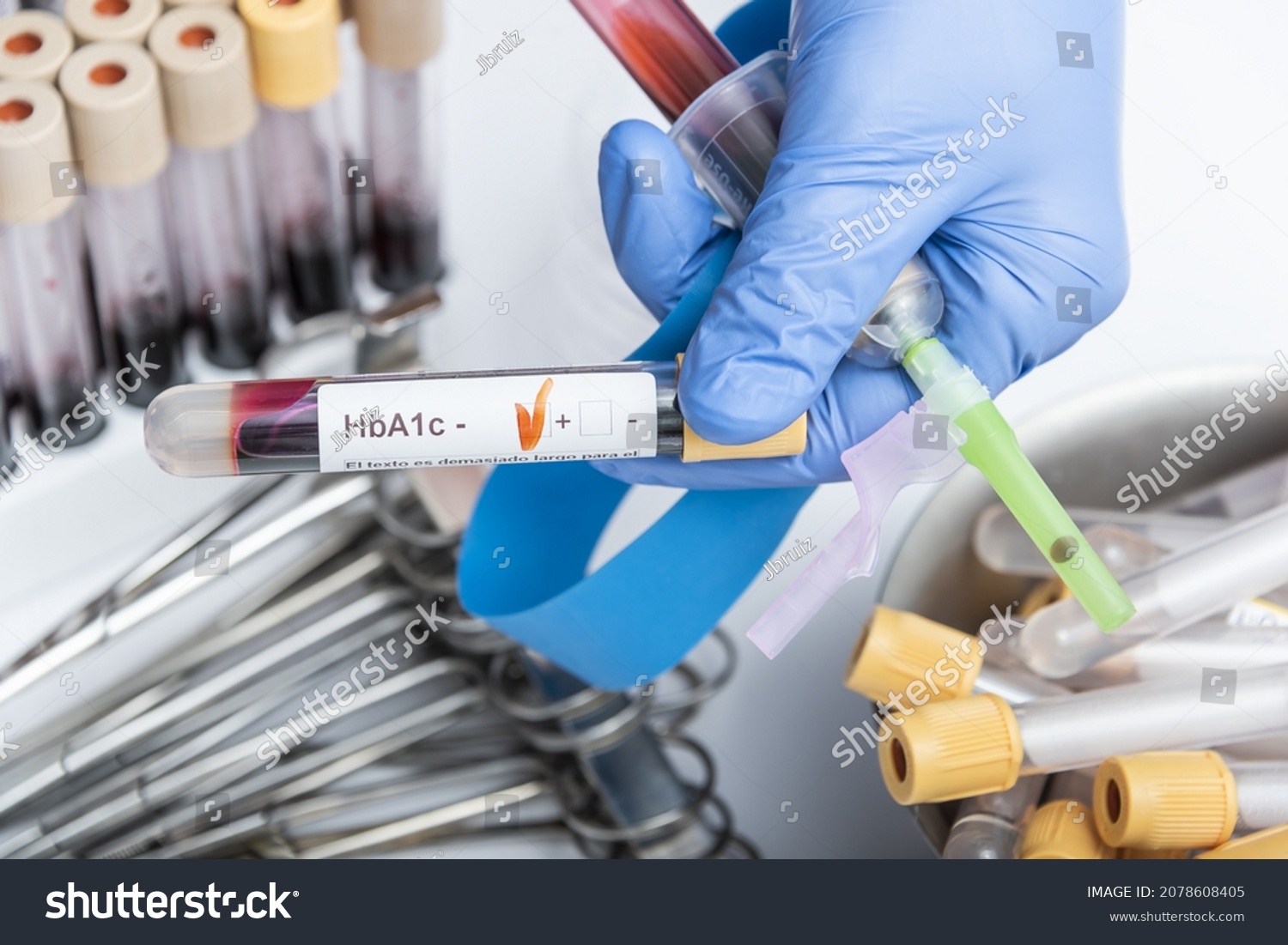 Blood Sample Hba1c Test Diabetes Diagnosis Stock Photo Edit Now