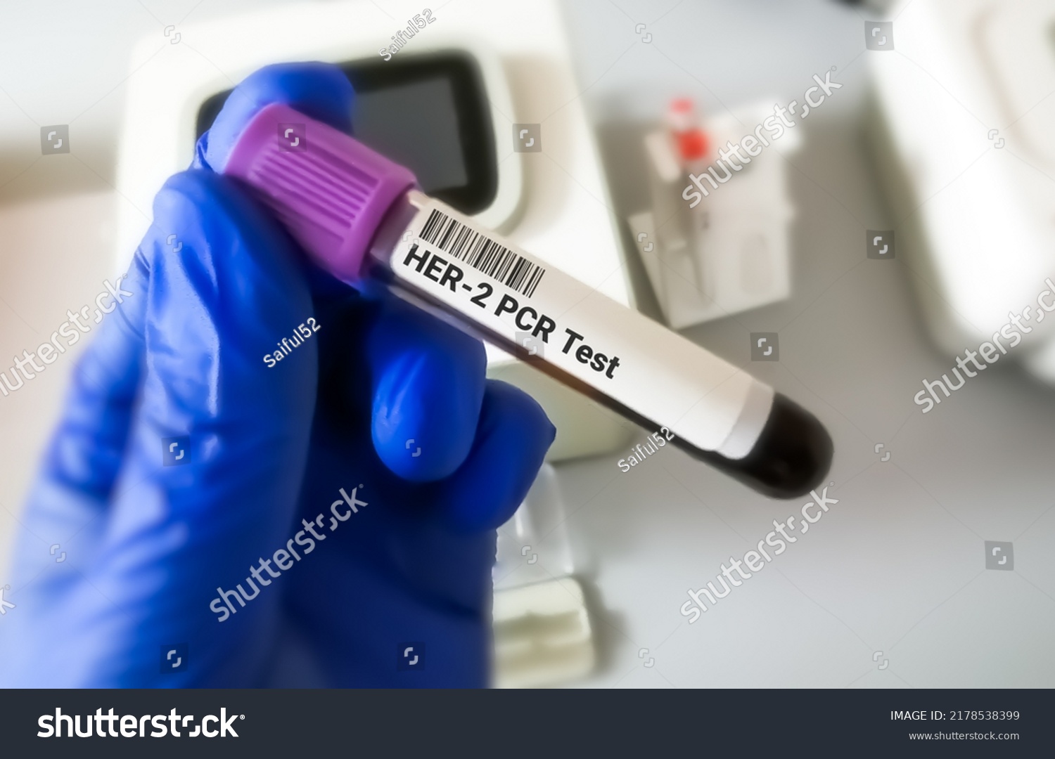 Blood Sample Her Human Epidermal Growth Stock Photo