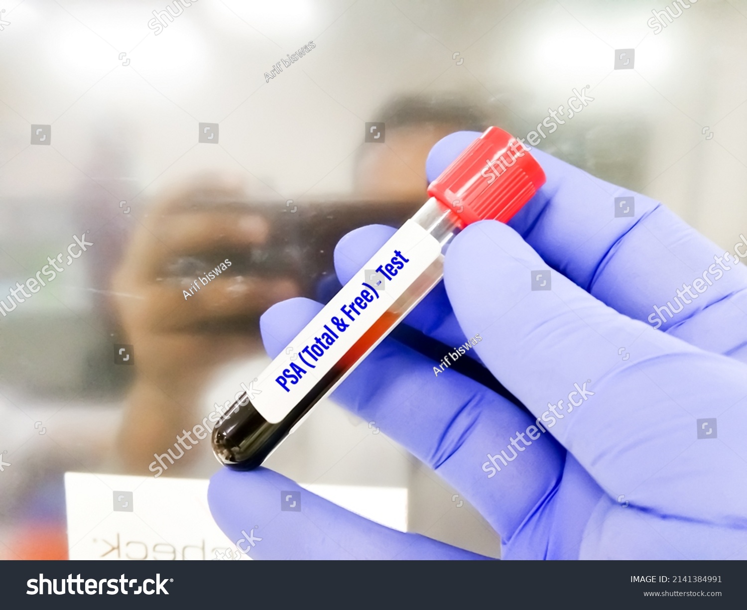 Blood Sample Psa Total Psa Free Stock Photo 2141384991 Shutterstock