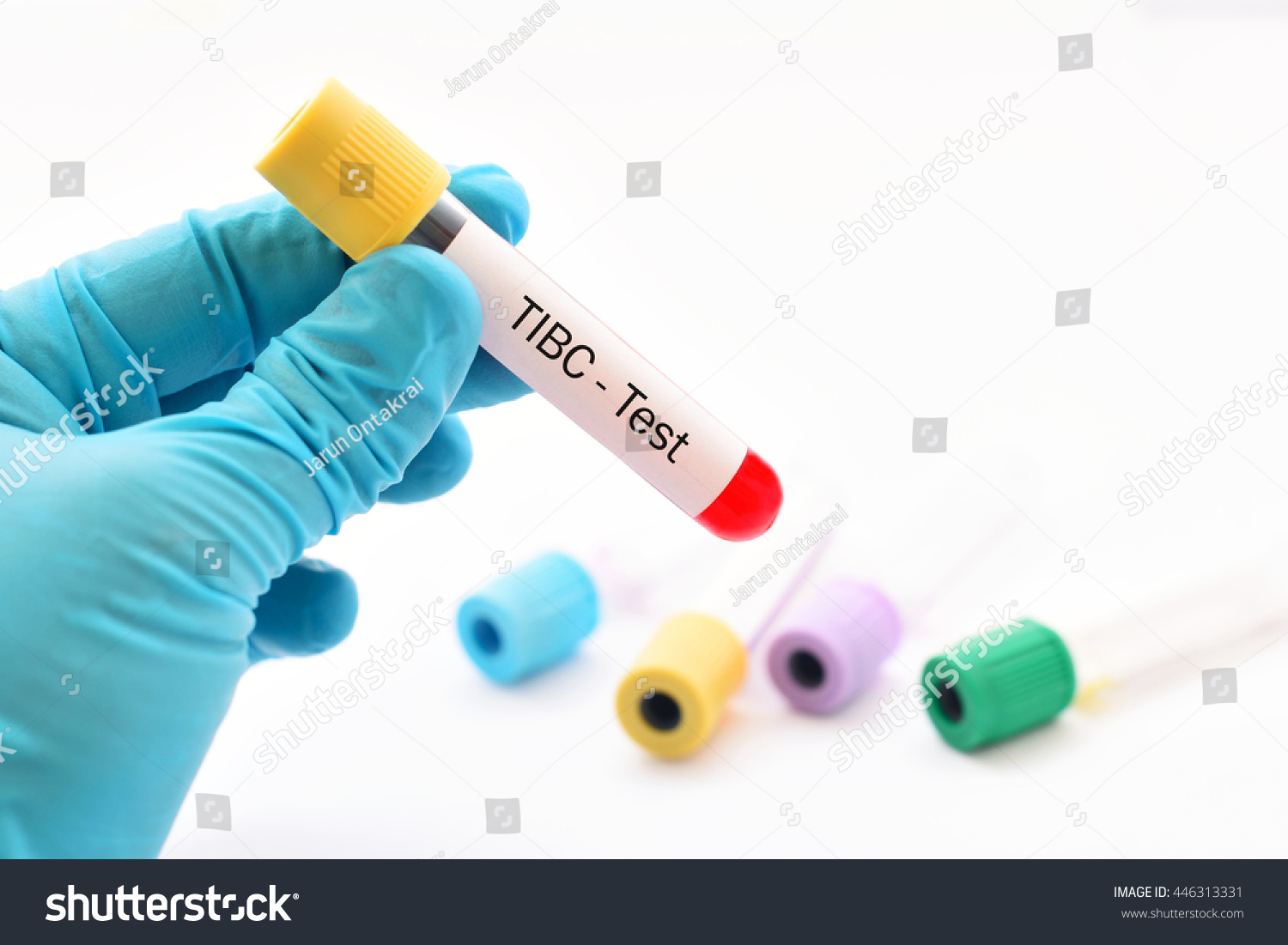 blood-sample-for-total-iron-binding-capacity-tibc-test-diagnosis-for