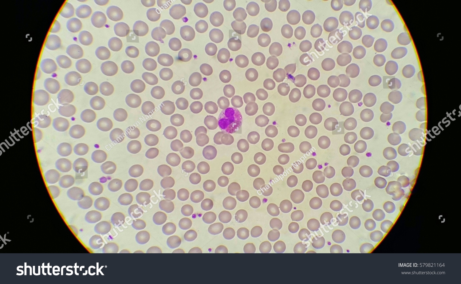 Blood Smear Under Microscope Present Eosinophil Foto De Stock Editar