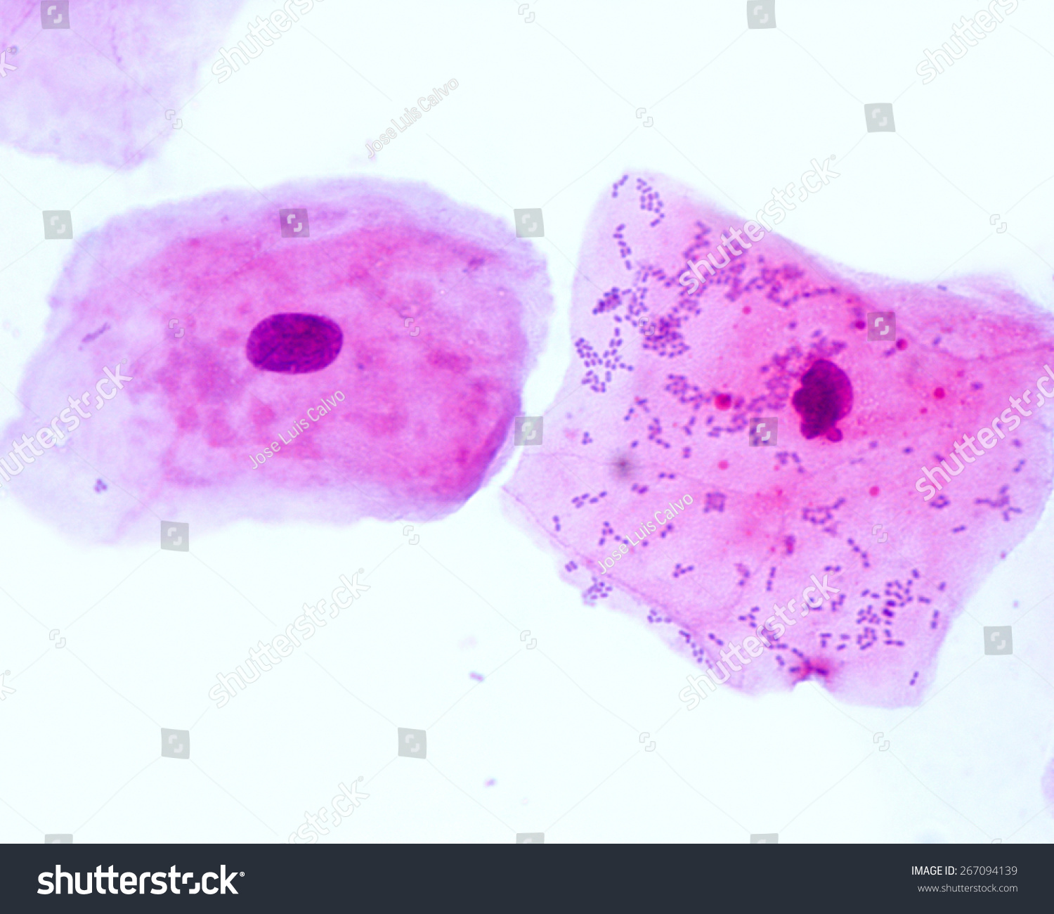 Buccal Smear Showing Desquamated Squamous Cells Of The Oral Mucosae Small Bluish Points Located