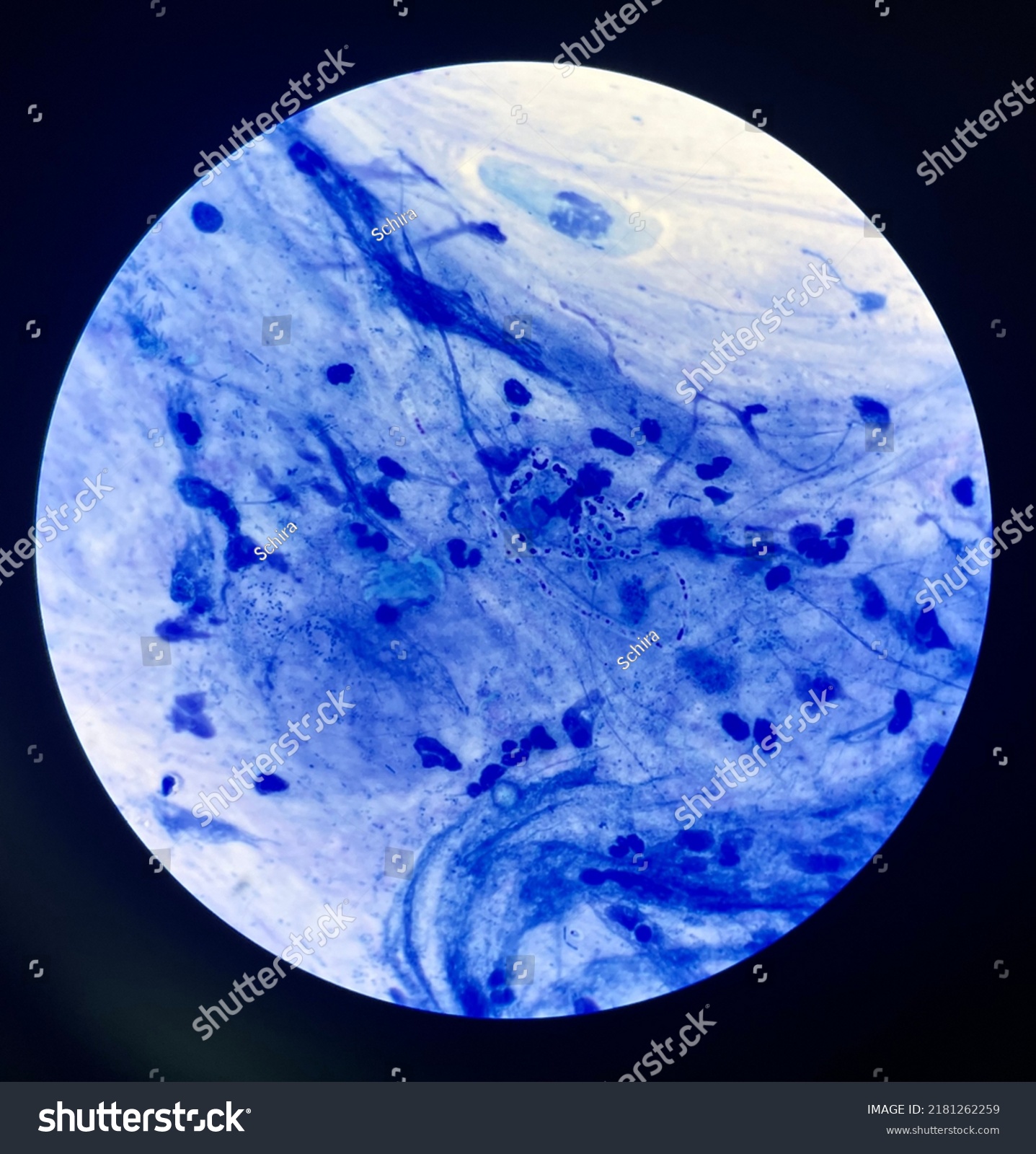 Budding Yeast Cells Sputum Gram Stain Stock Photo 2181262259 Shutterstock