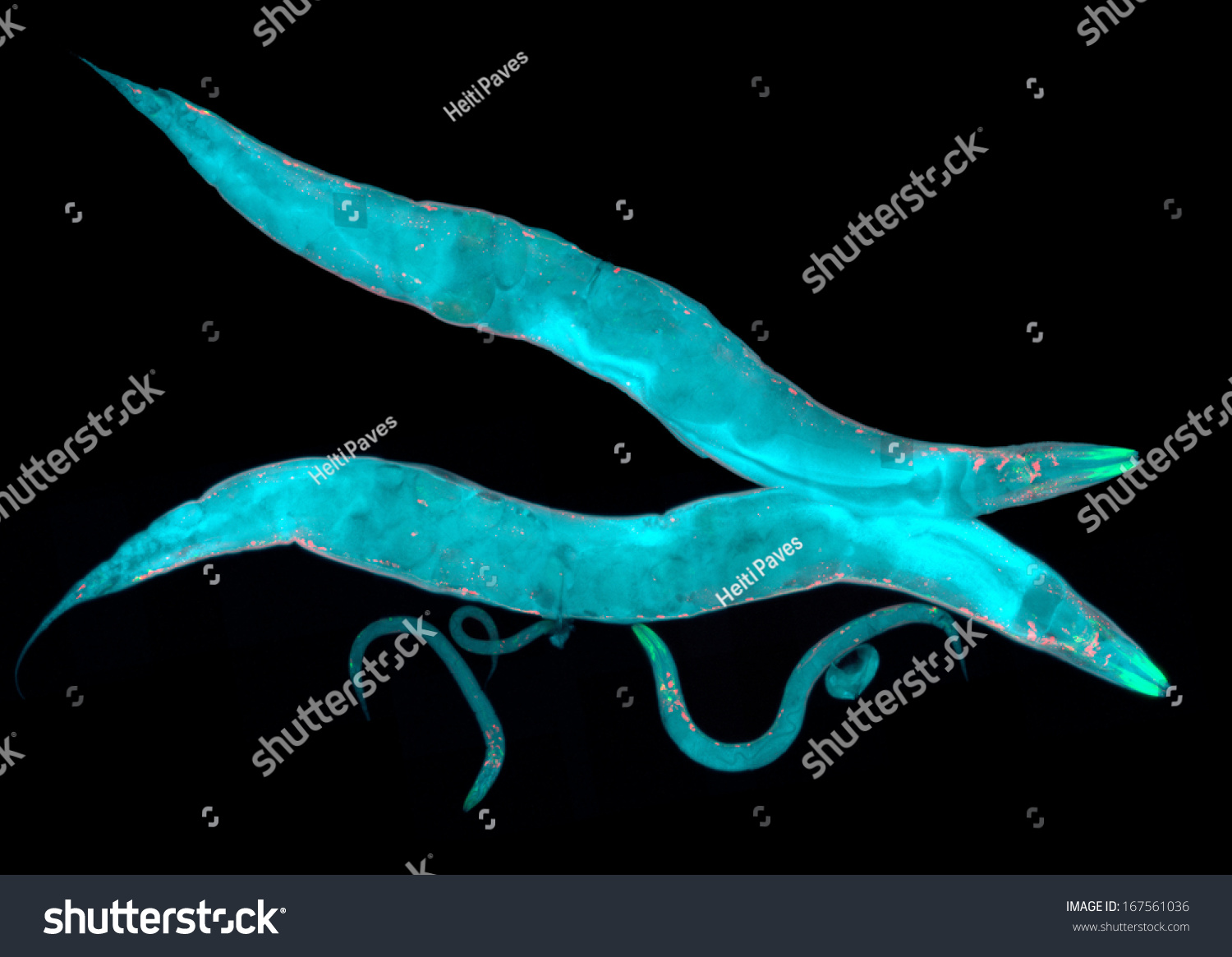 Caenorhabditis Elegans, A Free-Living Transparent Nematode (Roundworm ...