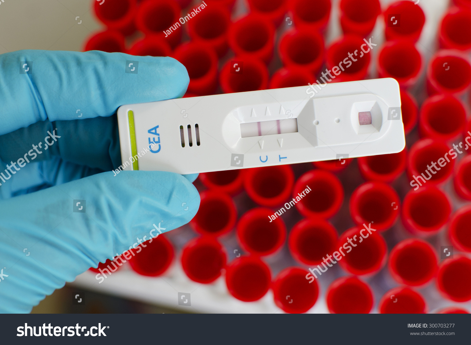 Cea (Carcinoembryonic Antigen) Testing By Using Test Cassette, The ...