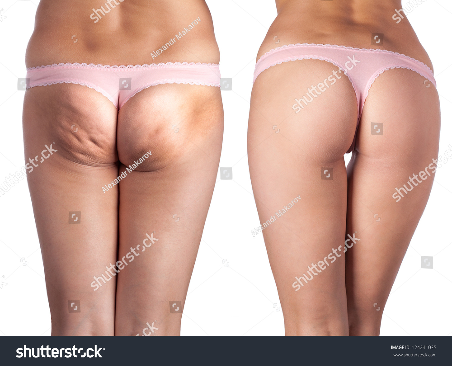 Women S Butt Pics 93
