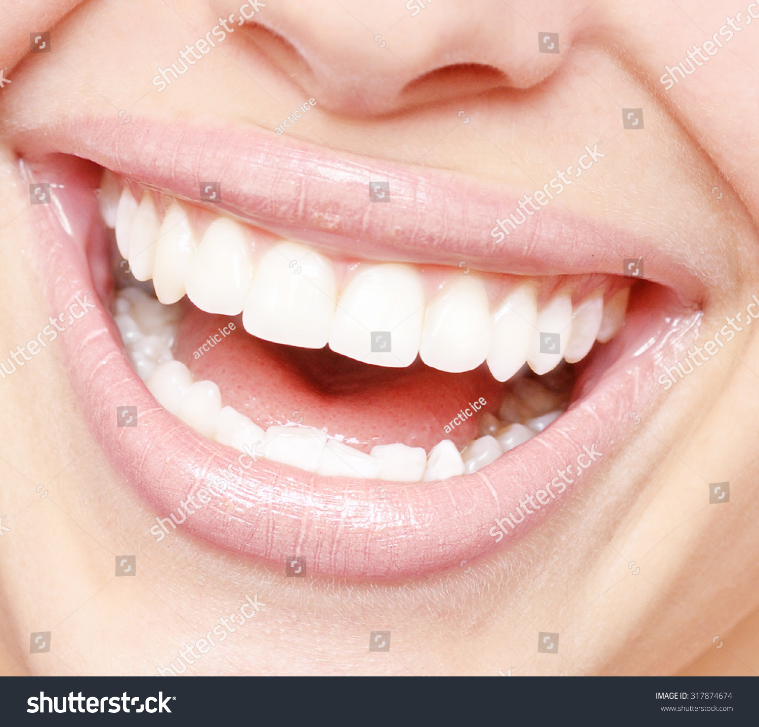 Close Up Of Bright Smile With Healthy Teeth Stock Photo 317874674 