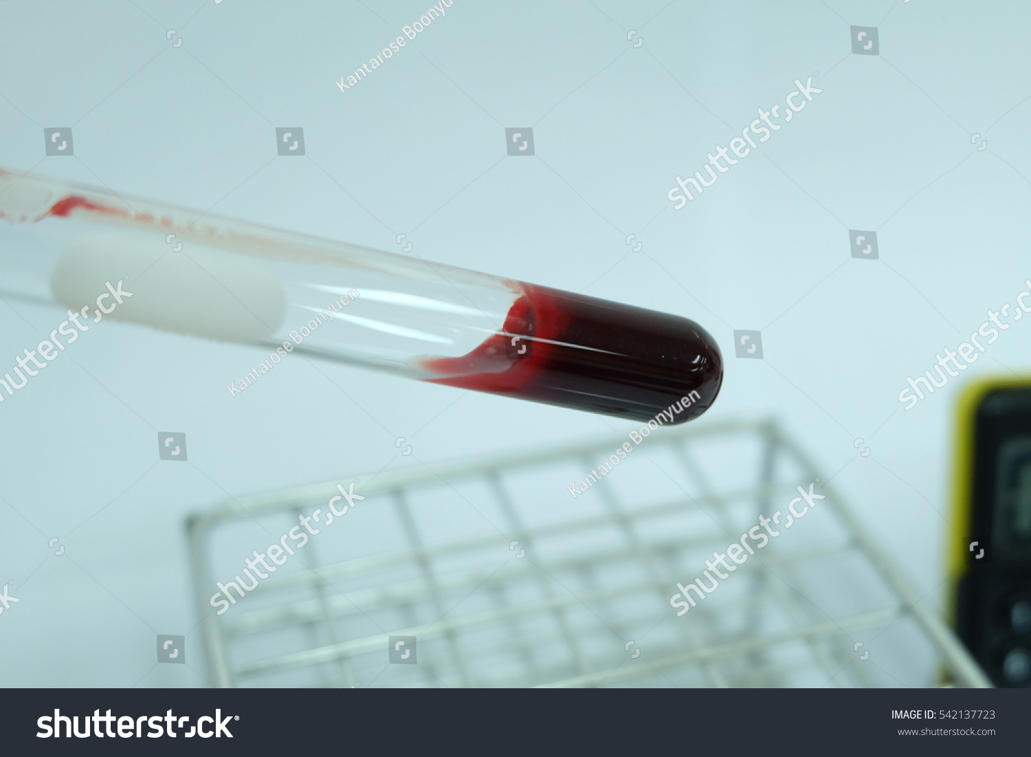 Clotted Blood In Grass Tube Stock Photo 542137723 Shutterstock