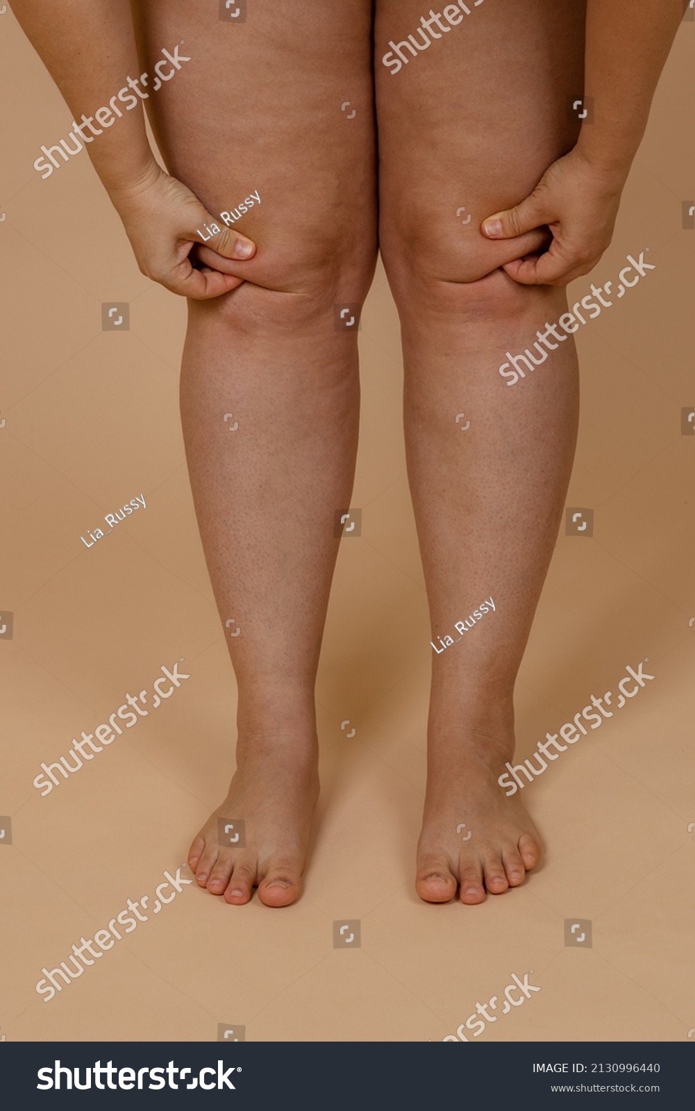 4 634 рез по запросу Chubby legs изображения стоковые фотографии