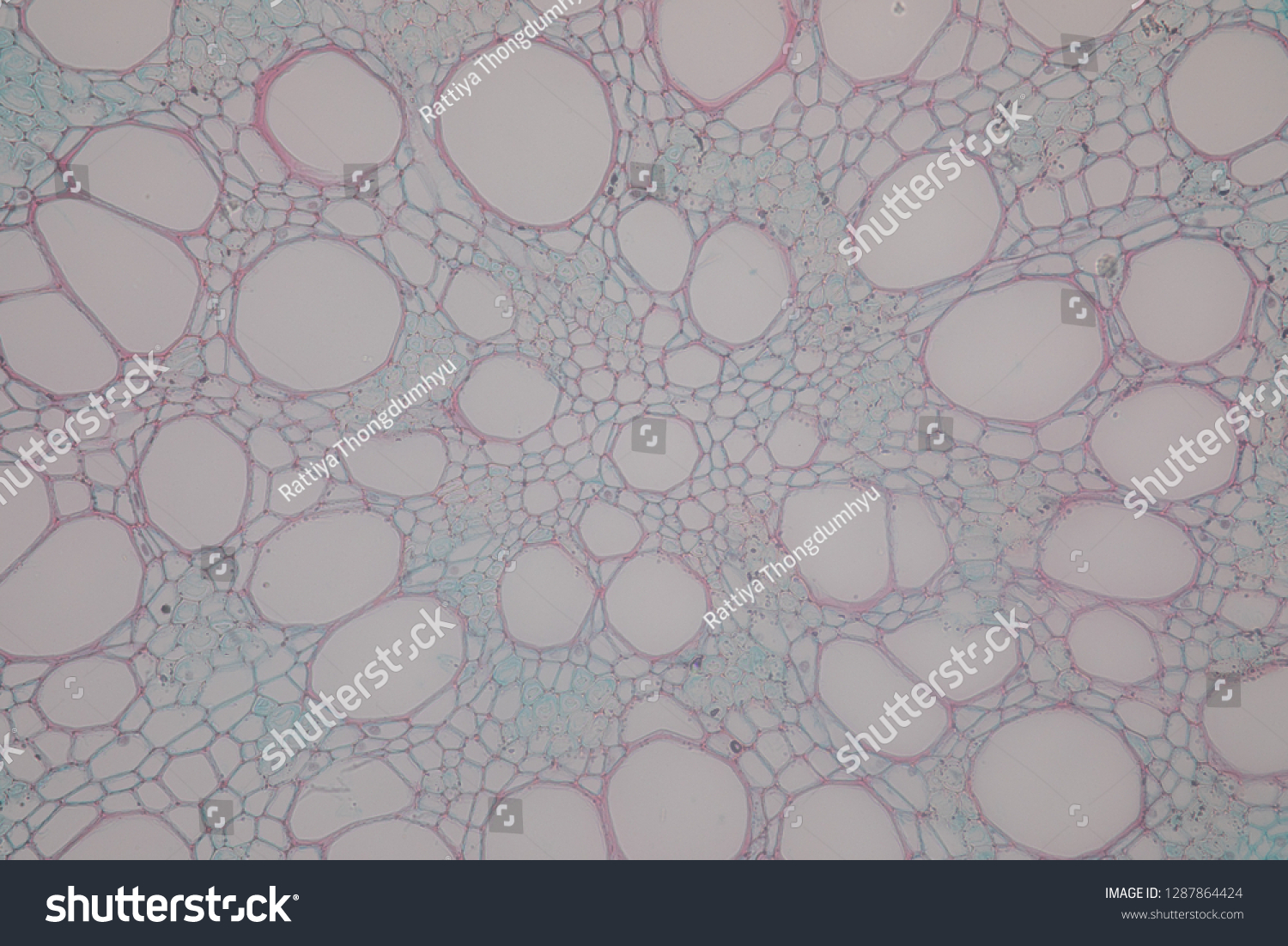 Crosssection Dicot Monocot Root Plant Stem Stock Photo