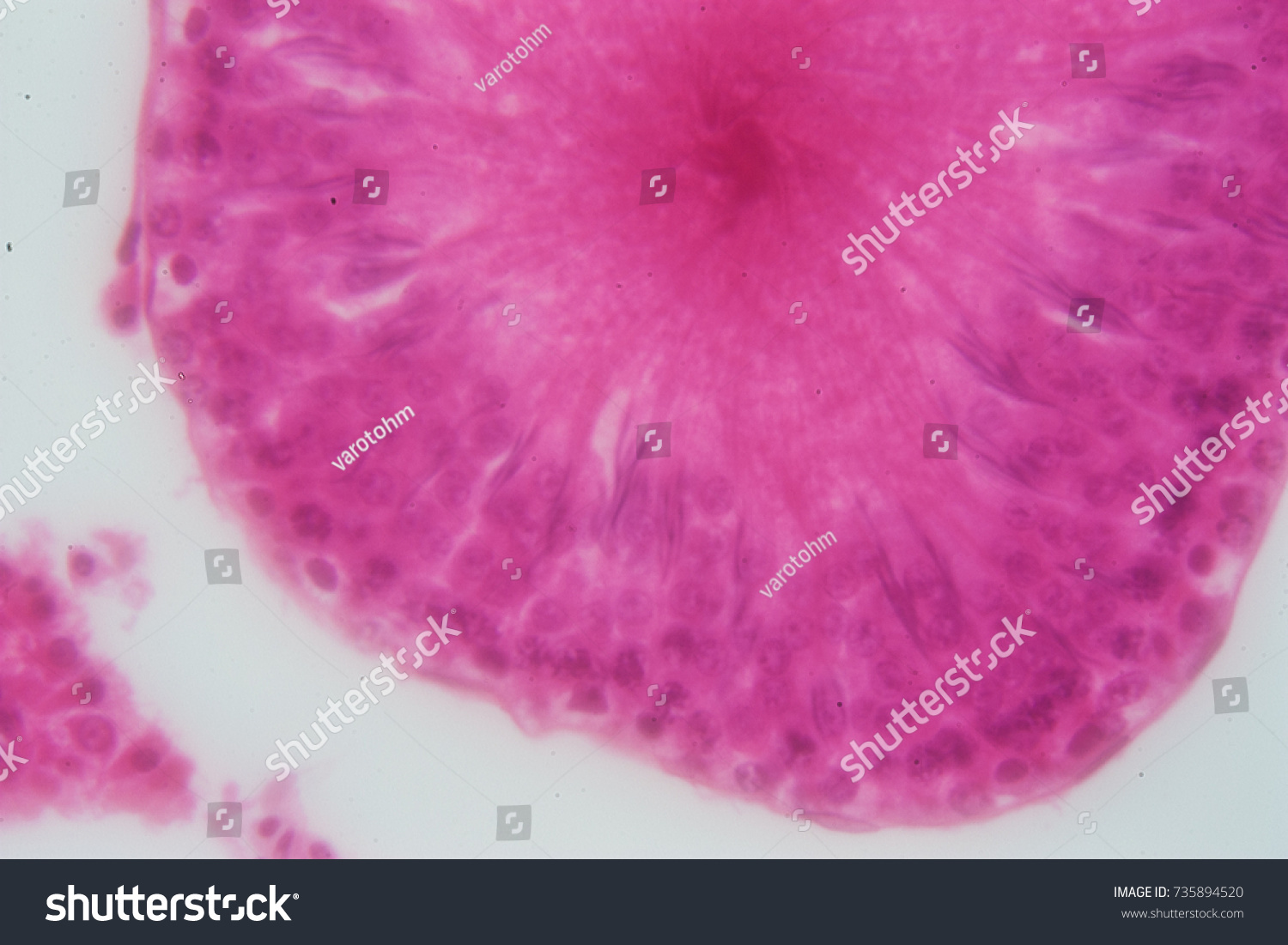 Cross Section Human Testis Under Microscope Foto De Stock Editar