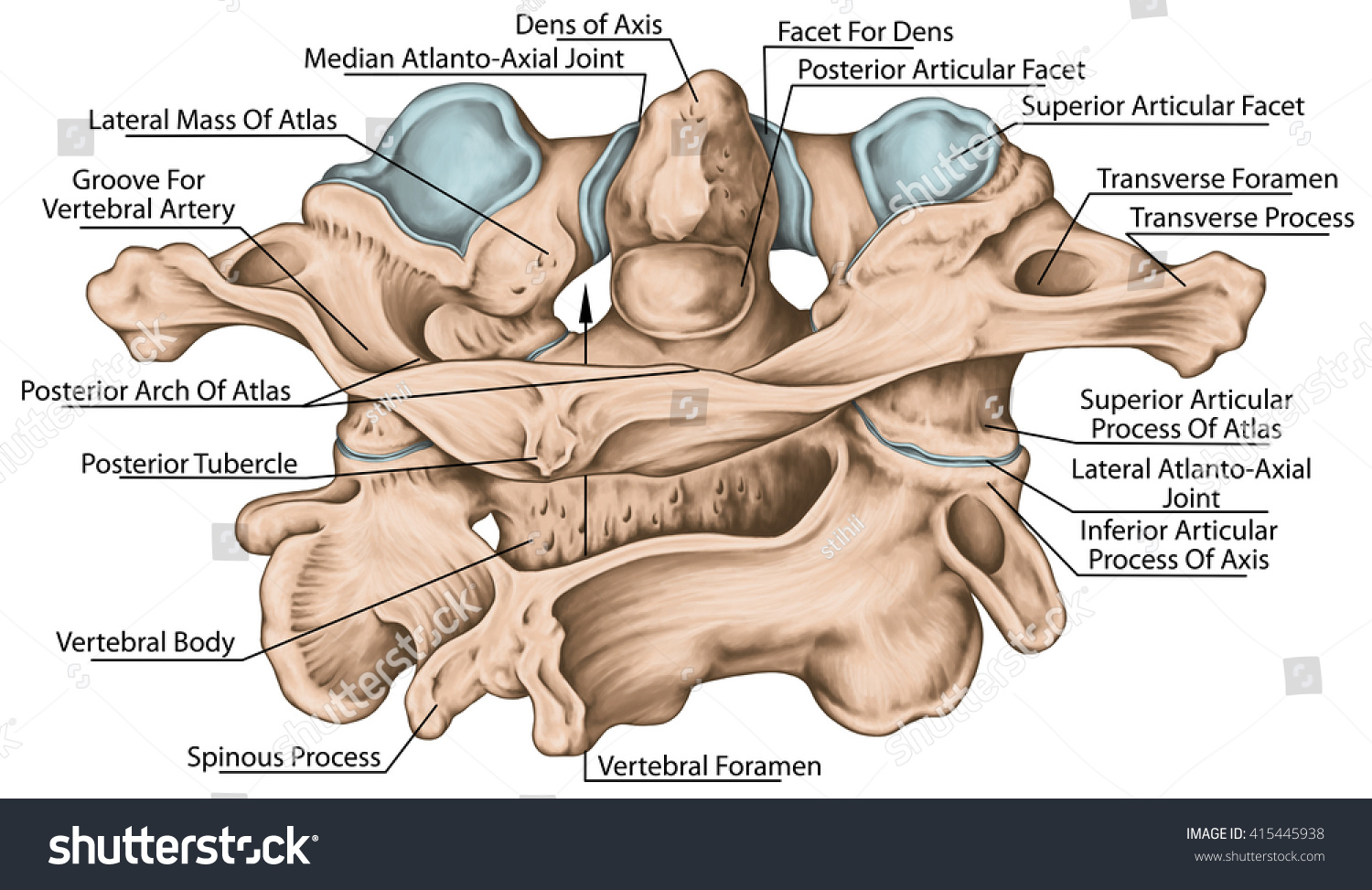 Didactic Board Cervical Spine Vertebral Morphology First And Second Cervical Vertebra 0445