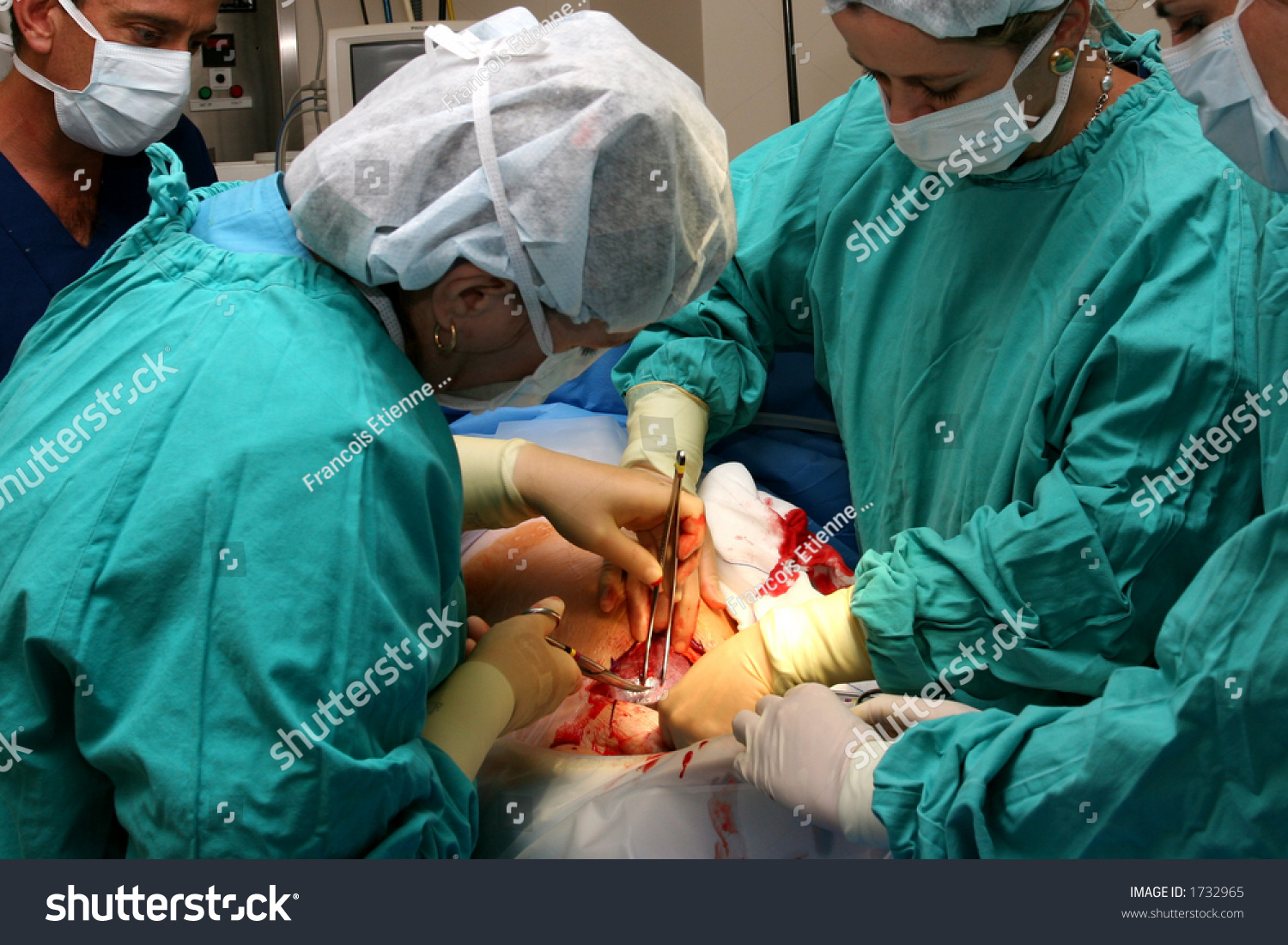 Doctors Operating On Patient Stock Photo 1732965 Shutterstock