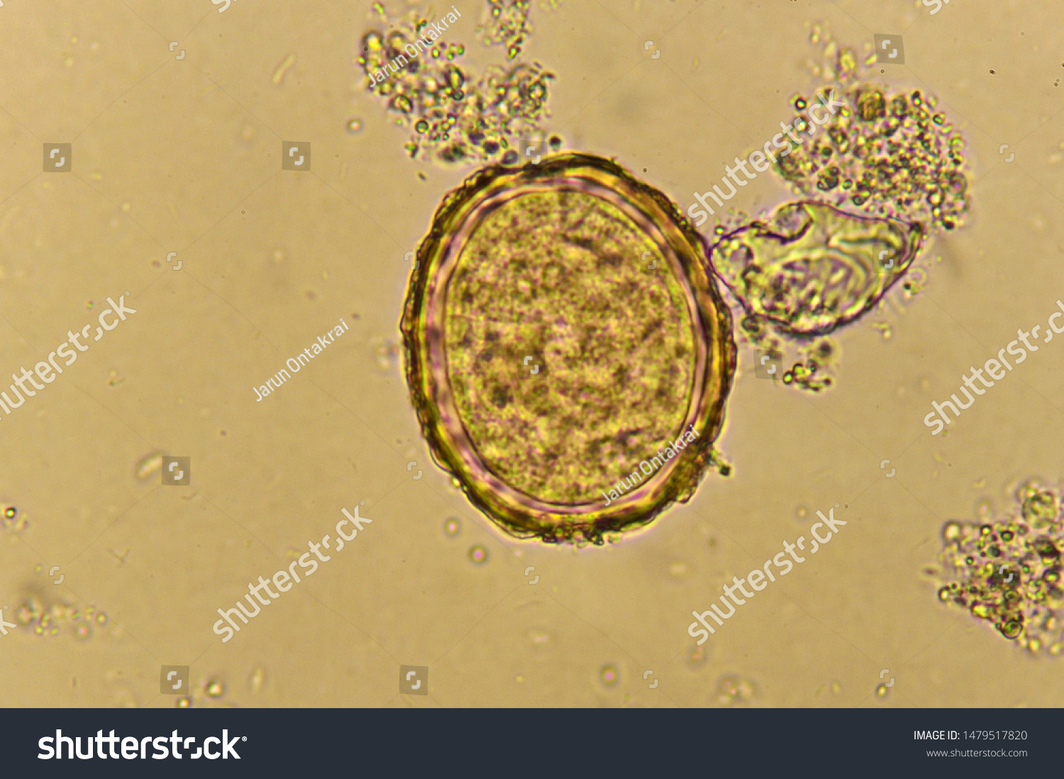 Egg Ascaris Lumbricoides Stool Analyze By Shutterstock