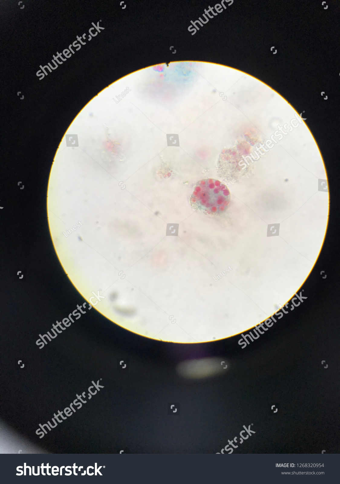 Foto Stok Entamoeba Histolytica Trophozoite Stage Light Microscope Edit Sekarang