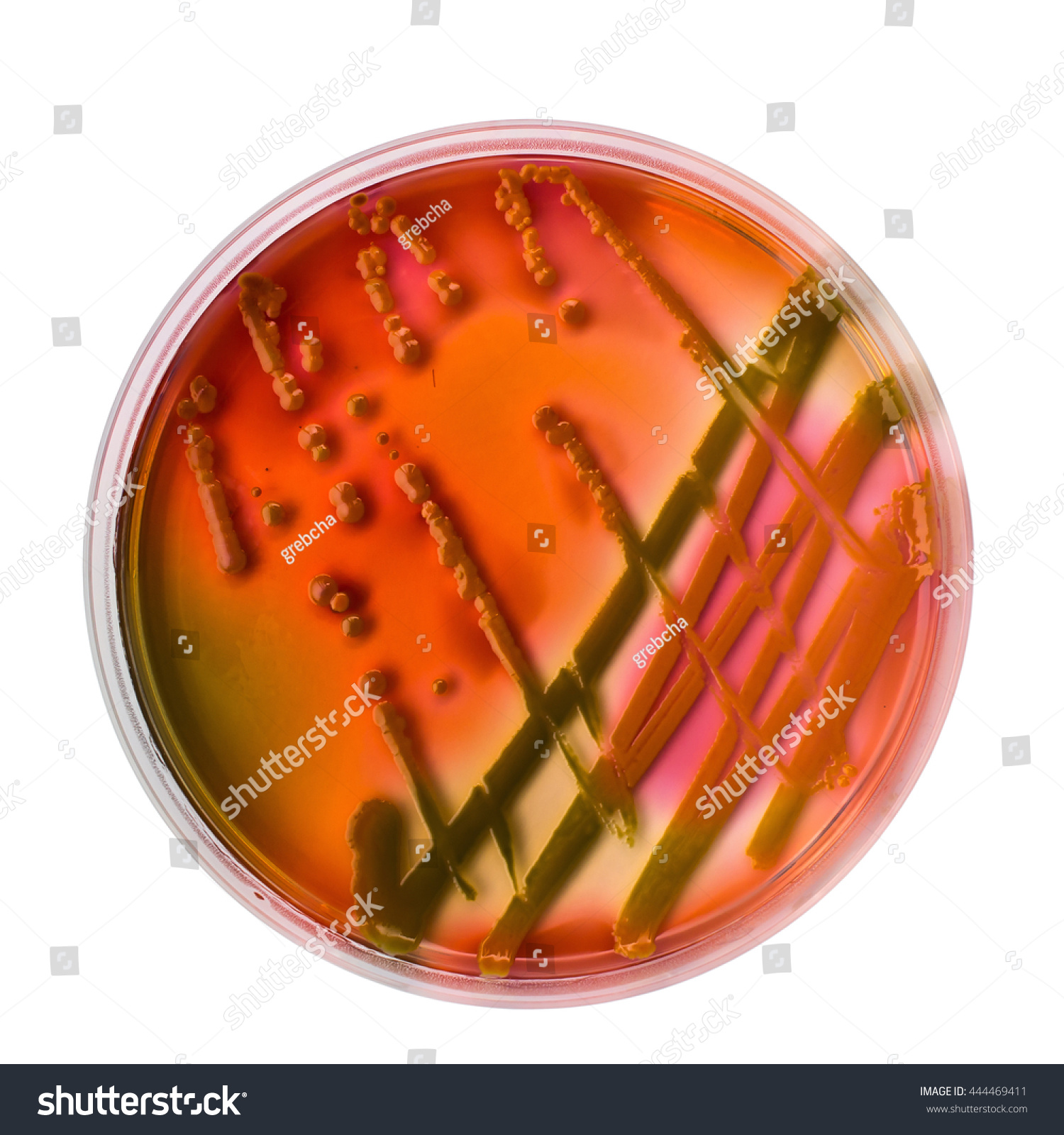 Enterobacteriacea Colonies On Hektoen Enteric Agar Stock Photo