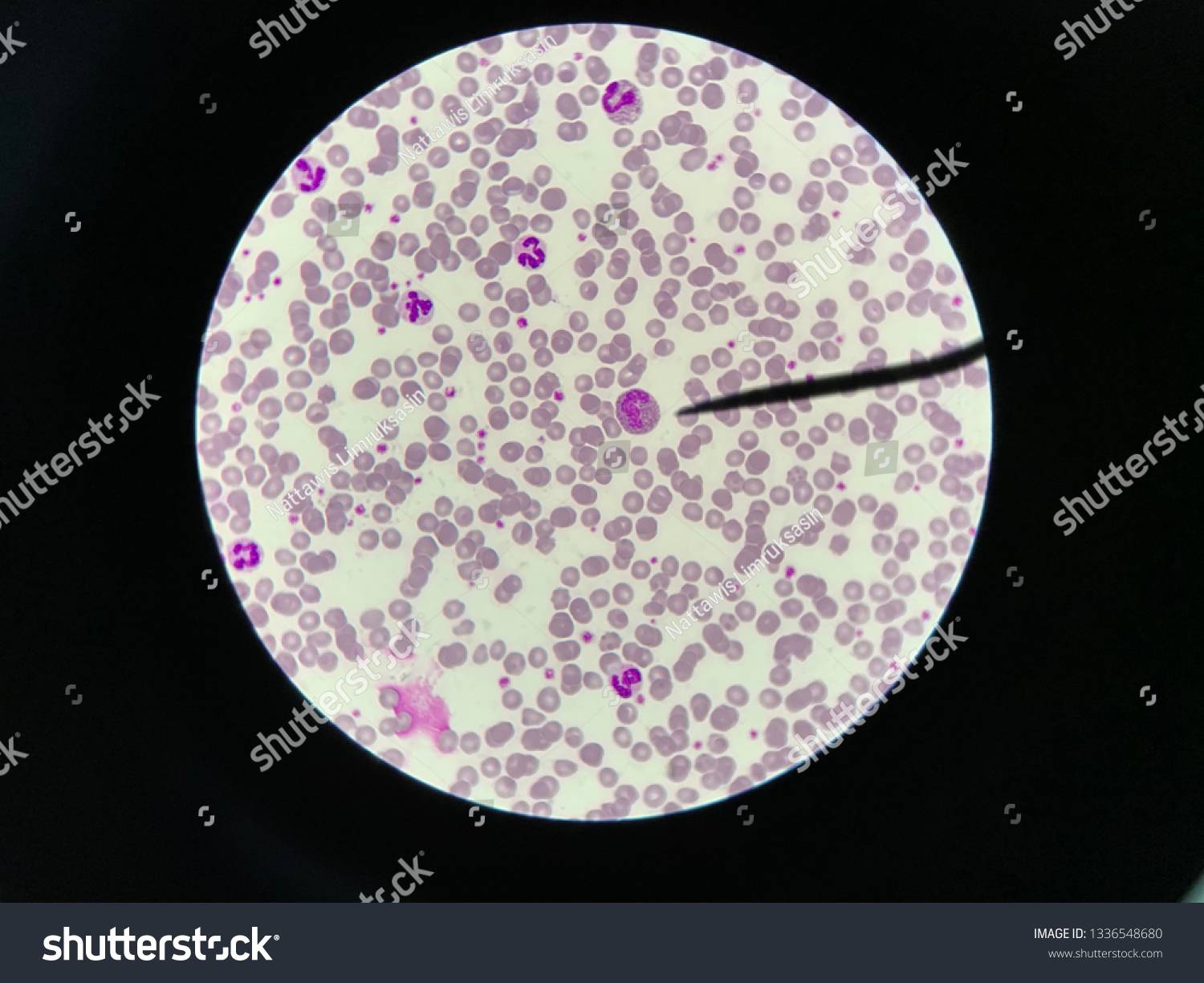 Eosinophil Cat Blood Smear Under